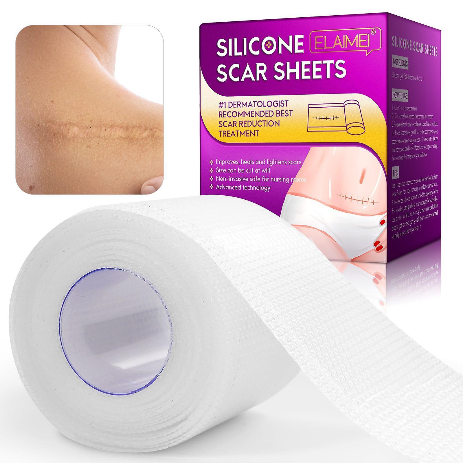 Gaoguang Silicone Scar Sheet C-sectionScar Removal Burns Silicone Scar Tape Roll Reusable And Breathable Mardi Gras Gifts Purple