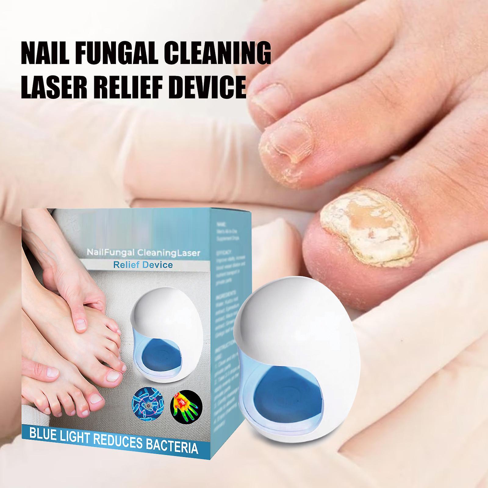 Fongwan Nail Fungus Laser Device, Nail Fungus Cleaning Laser Treatment Device for Onychomycosis, Light Therapy Onychomycosis Toes Treatment 1pcs B