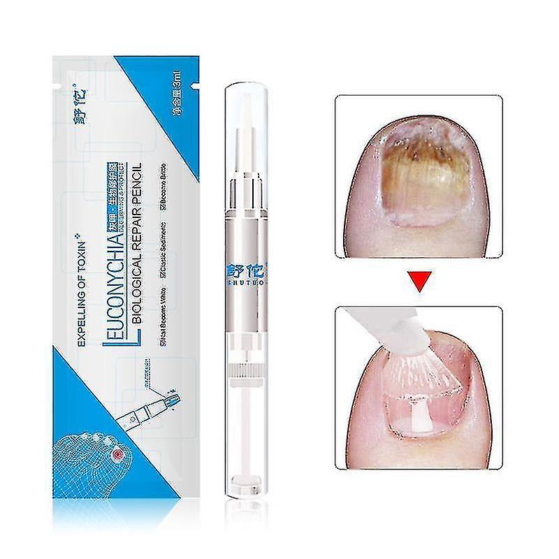 Exia 3 Pack 3ml Fungus Treatment Nail Oil Pen Anti-fungal Nail Cuticle Remover