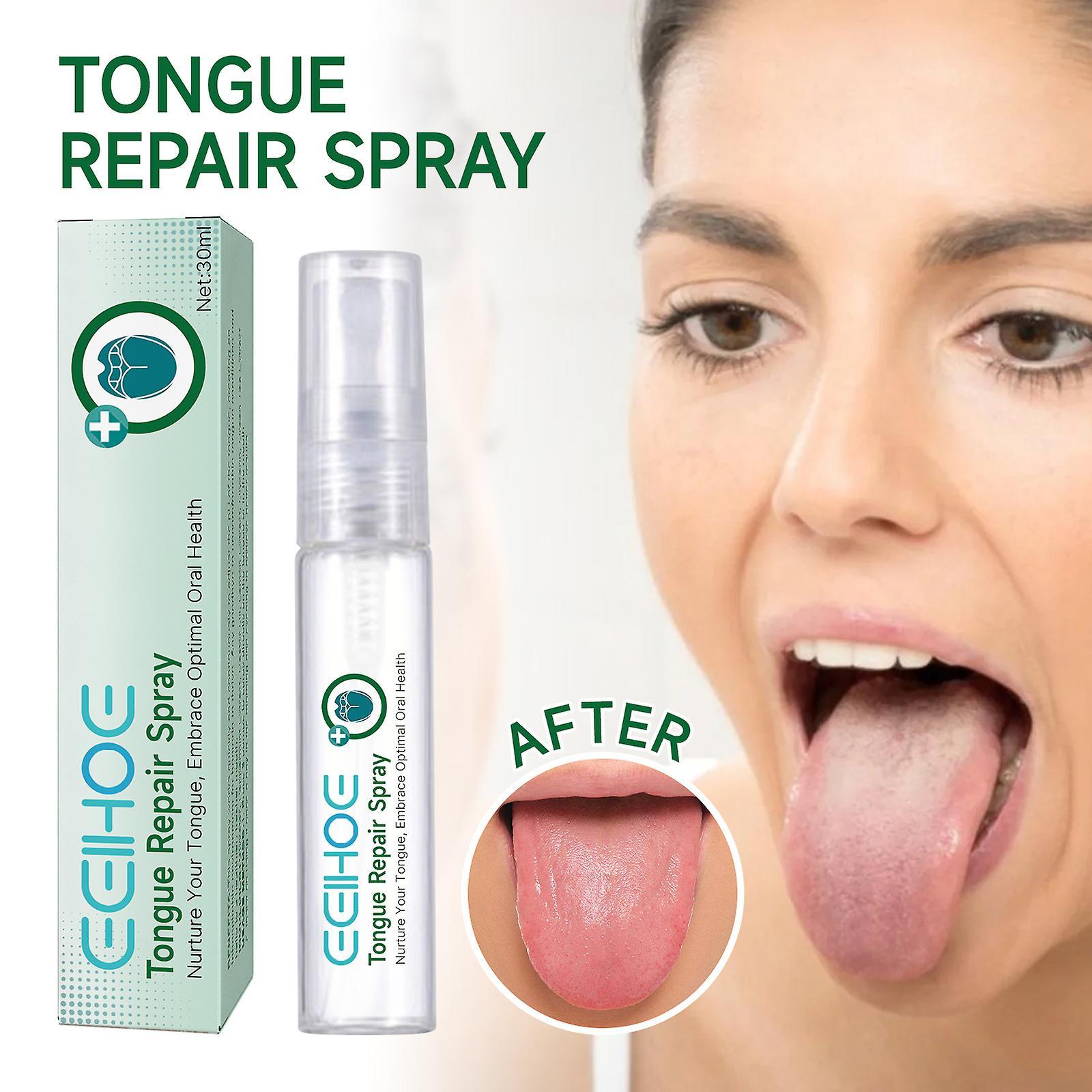 Frusde Tongue Repair Spray 30ml Reduce Swelling Tongue Relief Treatment Spray for Bad Breath, Tongue Repair Spray for Dryness& Bad Breath 3pcs