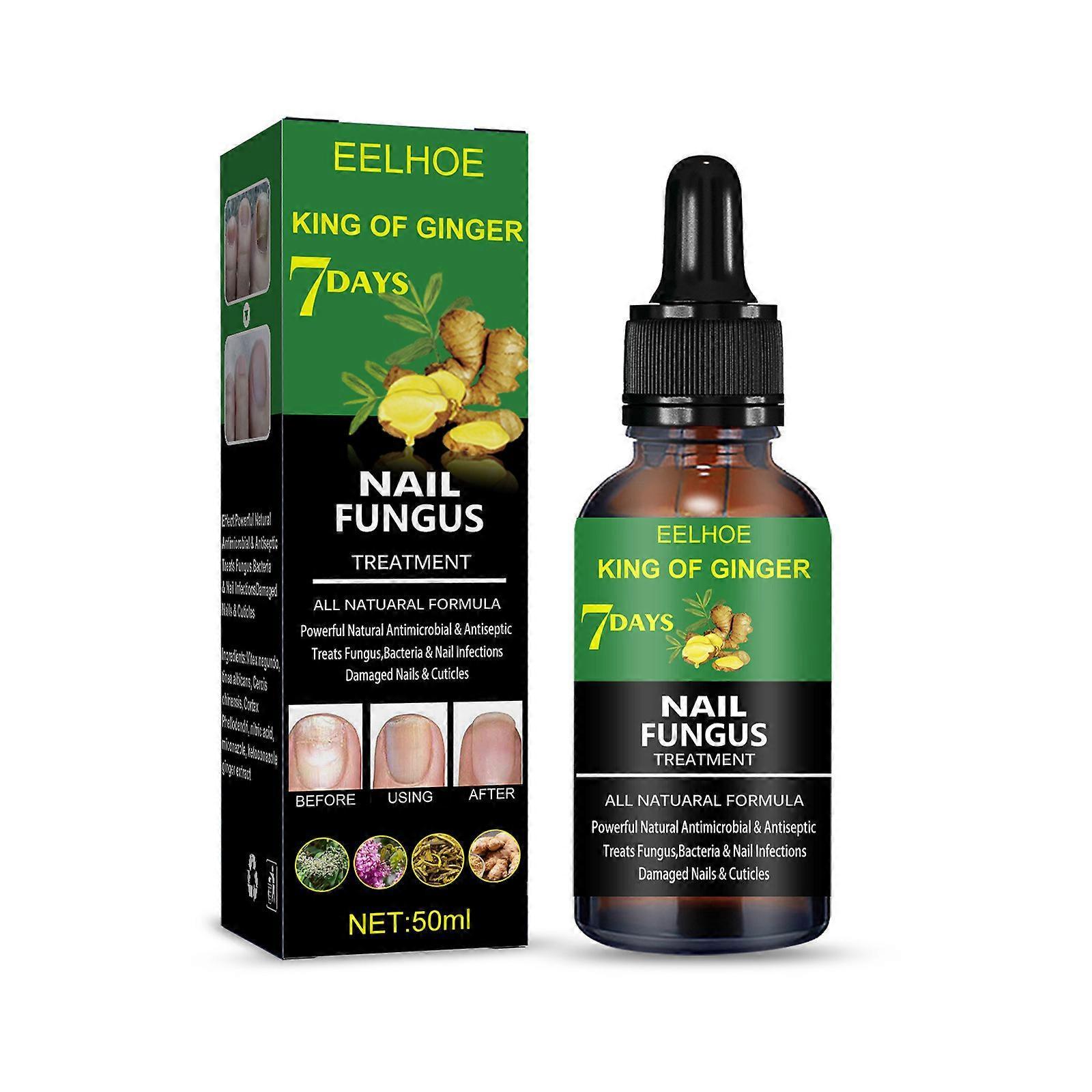 West&month 50ml Toenail Fungus Treatment, Extra Strength Nail Fungus Treatment For Toenail With Ginger Extract