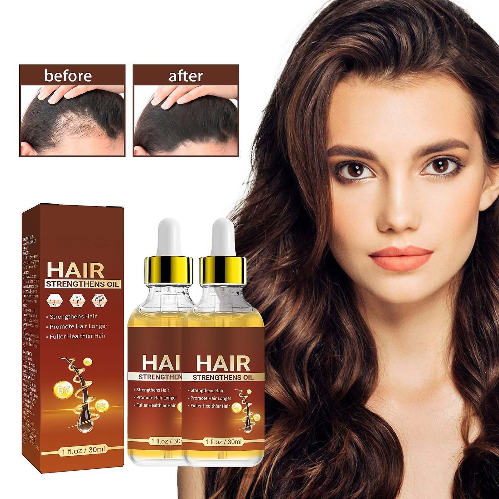 Flye 30ml Hair Growth Oil With Biotin And Castor  Hair Growth Serum For Thicker Longer Healthier Hair  Promotes Hair Regrowth  Hair Regrowth Oil 24...