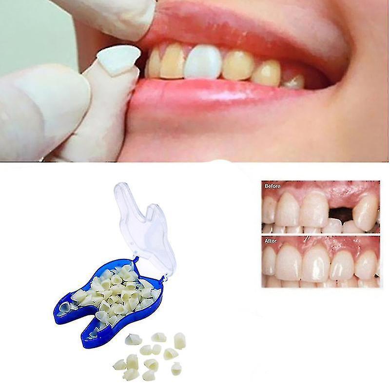 Phwj Temporary Tooth Repair Kit Teeth And Gaps Teeth Teeth Whitening Tooth Back Teeth