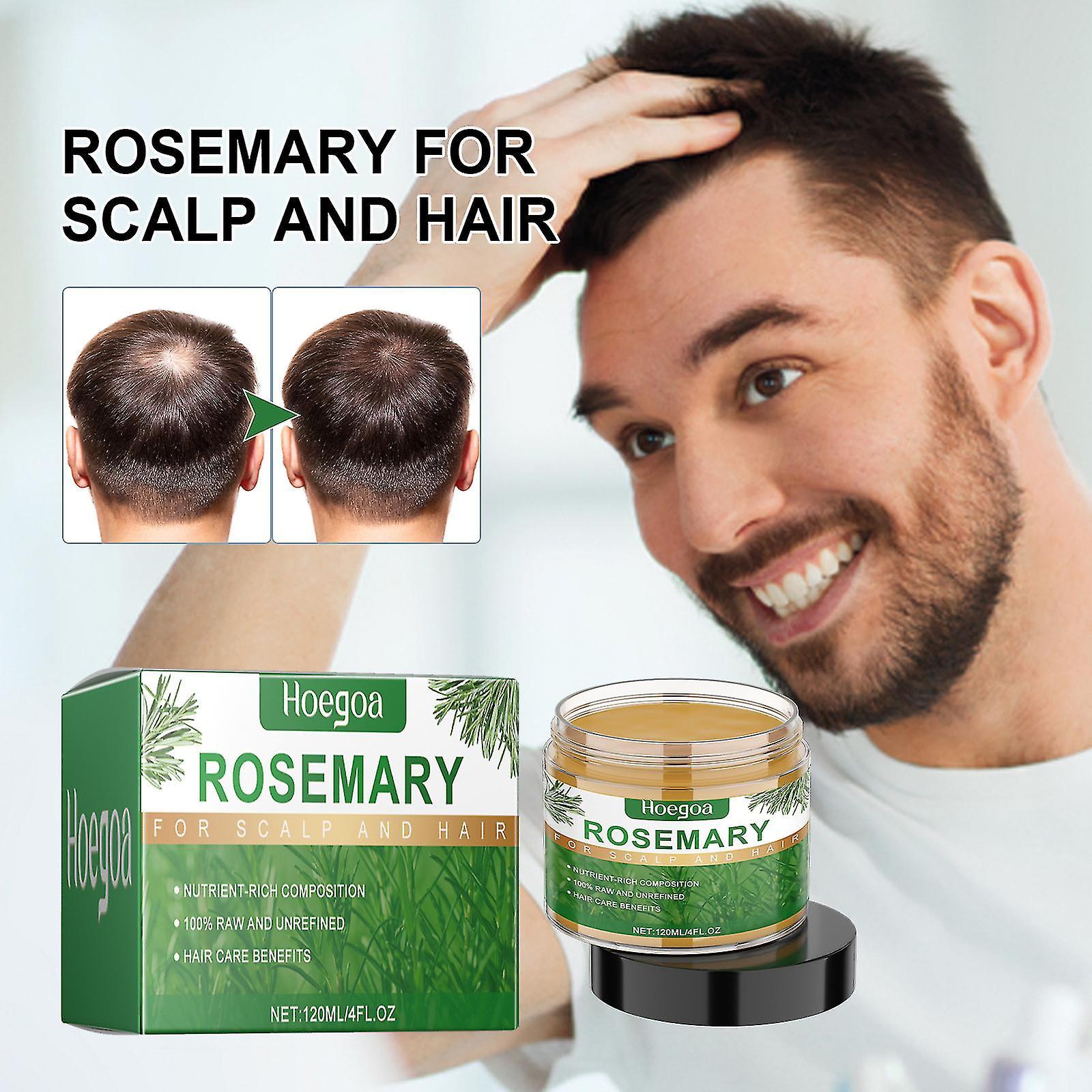 Windo Rosemary Oil For Hair Growth, Rosemary Essential Oil For Hair Loss Regrowth Treatment, Rosemary Oil For Dry and Damaged Hair 2pcs