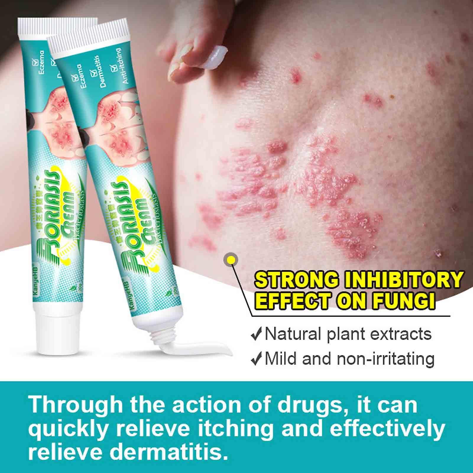 Gaoguang Psoriasis Cream Skin Moss Removal Cream Pityriasis Versicolor Sweat Spots Skin Itching Cream 20g Mardi Gras Gifts White