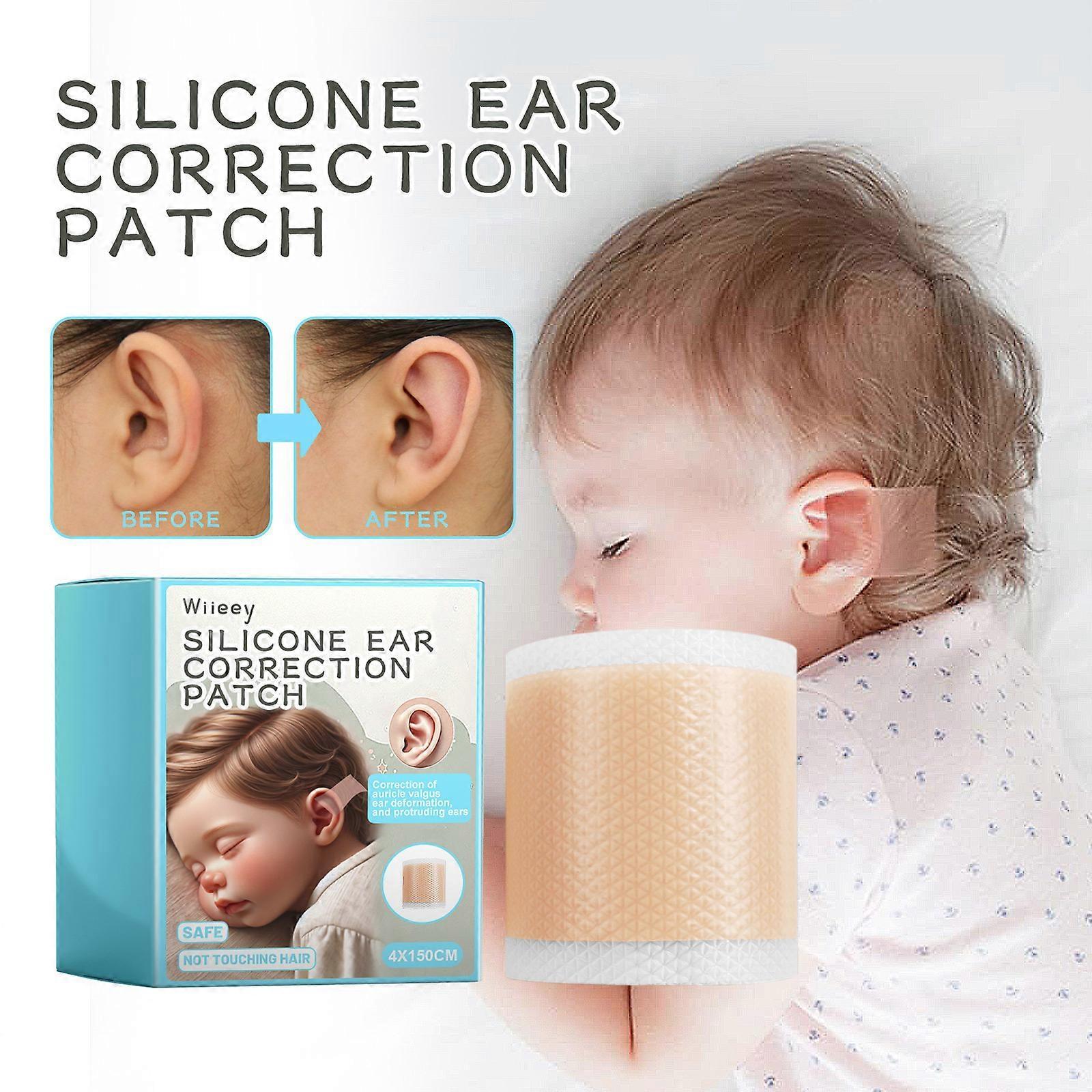 Unbrand Silicone Ear Correctors Tape, Baby Auricle Valgus Correction Patch, Newborn Baby Ear Aesthetic Correctors Kids Infant Protruding Ear Correc...