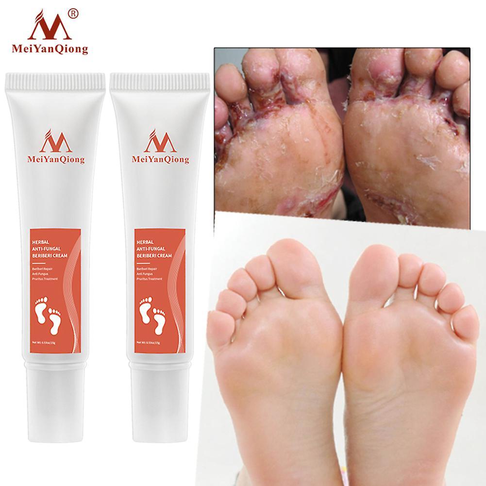 Skin Care Foot Cream Anti Fungal Infection Fungus Gel Repair Dry Crack Toe Treatment15ml