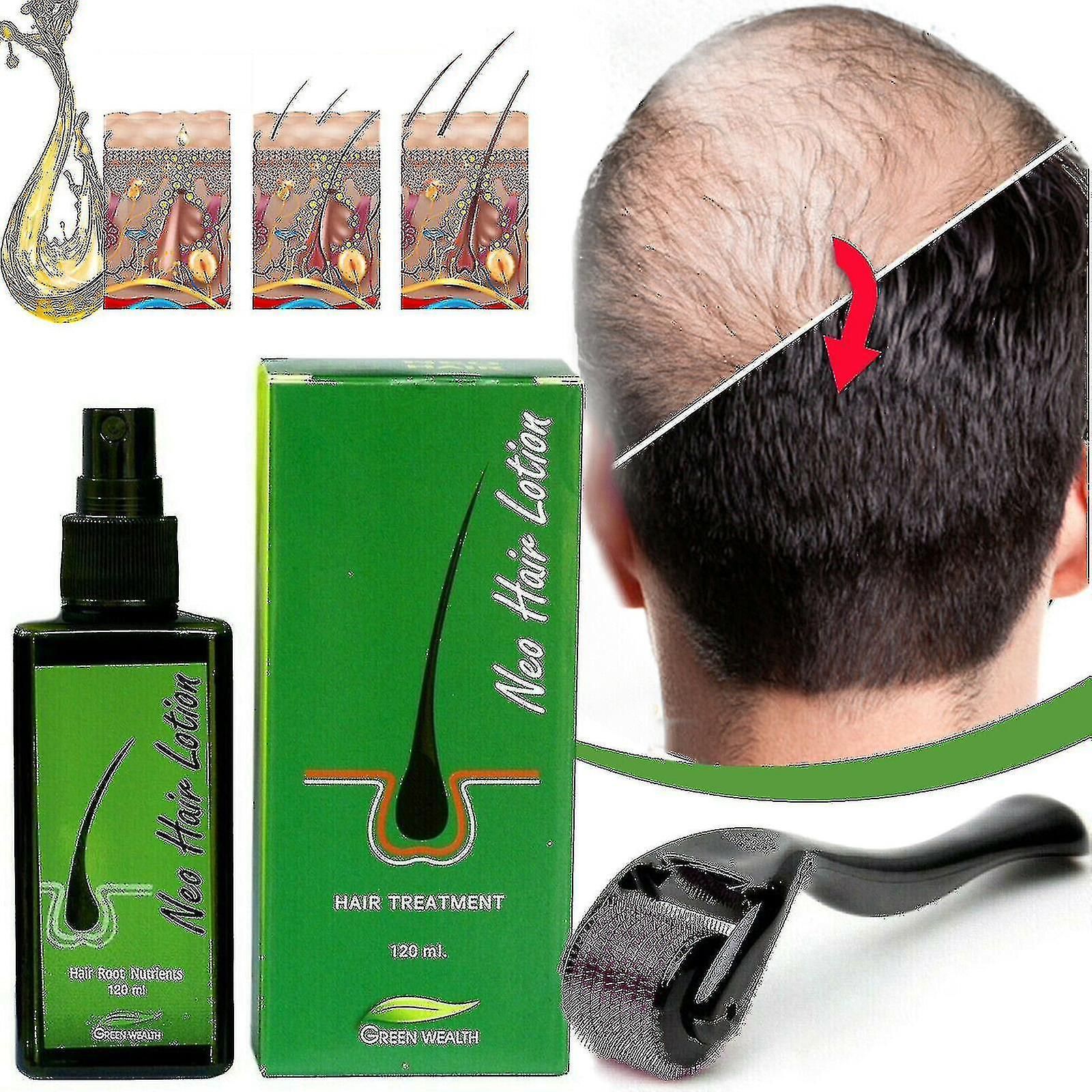 Scaji Neo Hair Regrowth Lotion Haircare / Hair Loss Oil / Baldness/ 1 Derma Roller