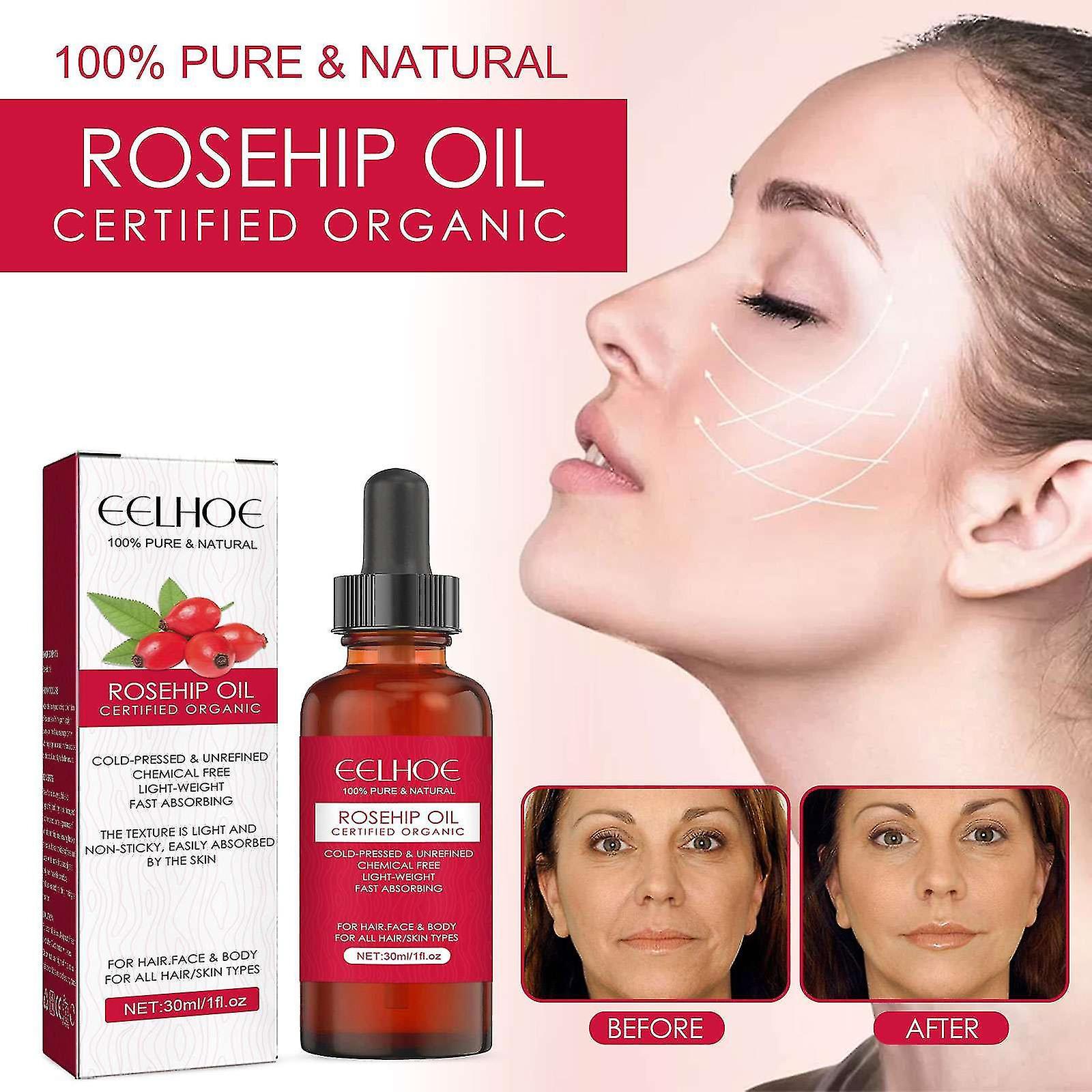 Kakanwo Rose Hip Facial Oil Clearance Promotion As Show Free Size