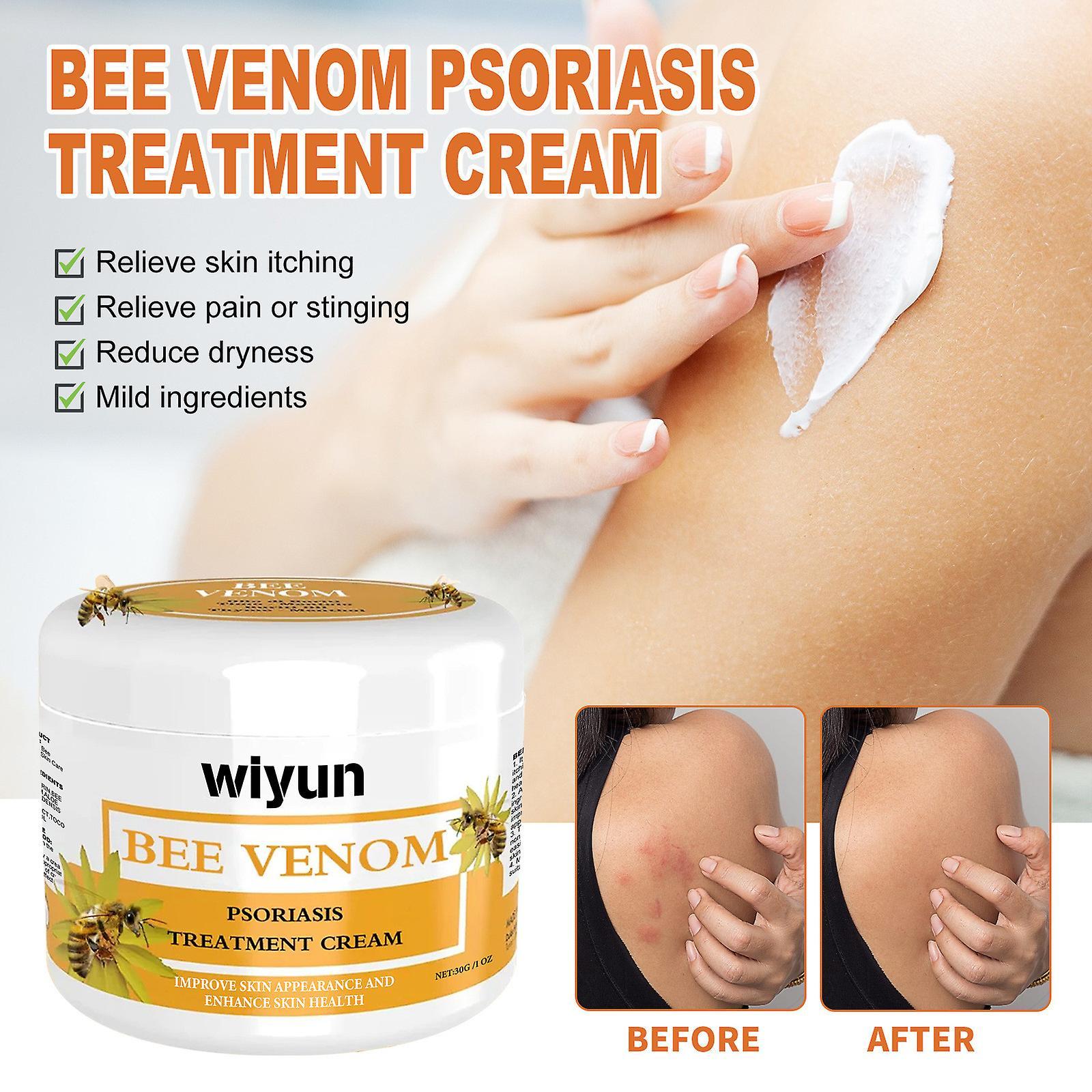 Kakanwo Bee Venoms Psoriasis Treatments Cream As Show Free Size