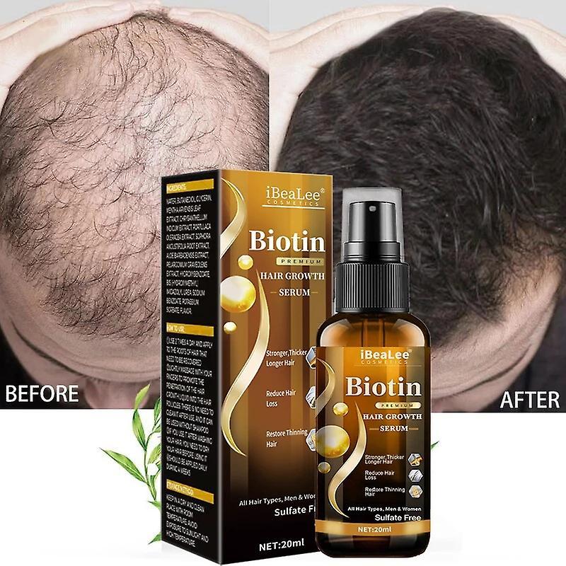 Frusde Biotin Hair Growth Serum Spray, Biotin Premium Hair Growth Serum, Biotin Hair Growth Spray Biotin Herbal Serum For Thicker Longer & Stronger...