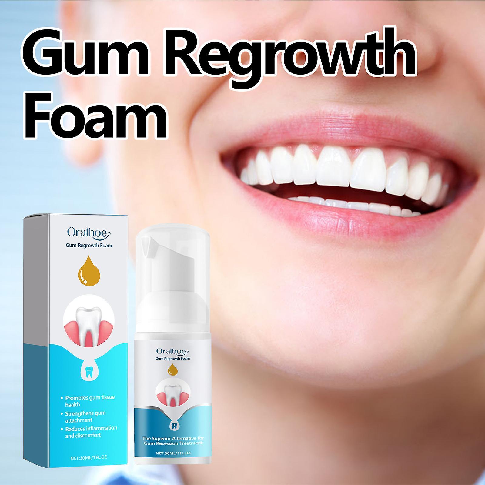 Fongwan Gum Regrowth Form, Gum Shield Therapy Mouthwash Restore Gum Health, Oral Care Instant Gum Repair Gel Teeth Whitening Essence Mousse 3pcs - ...