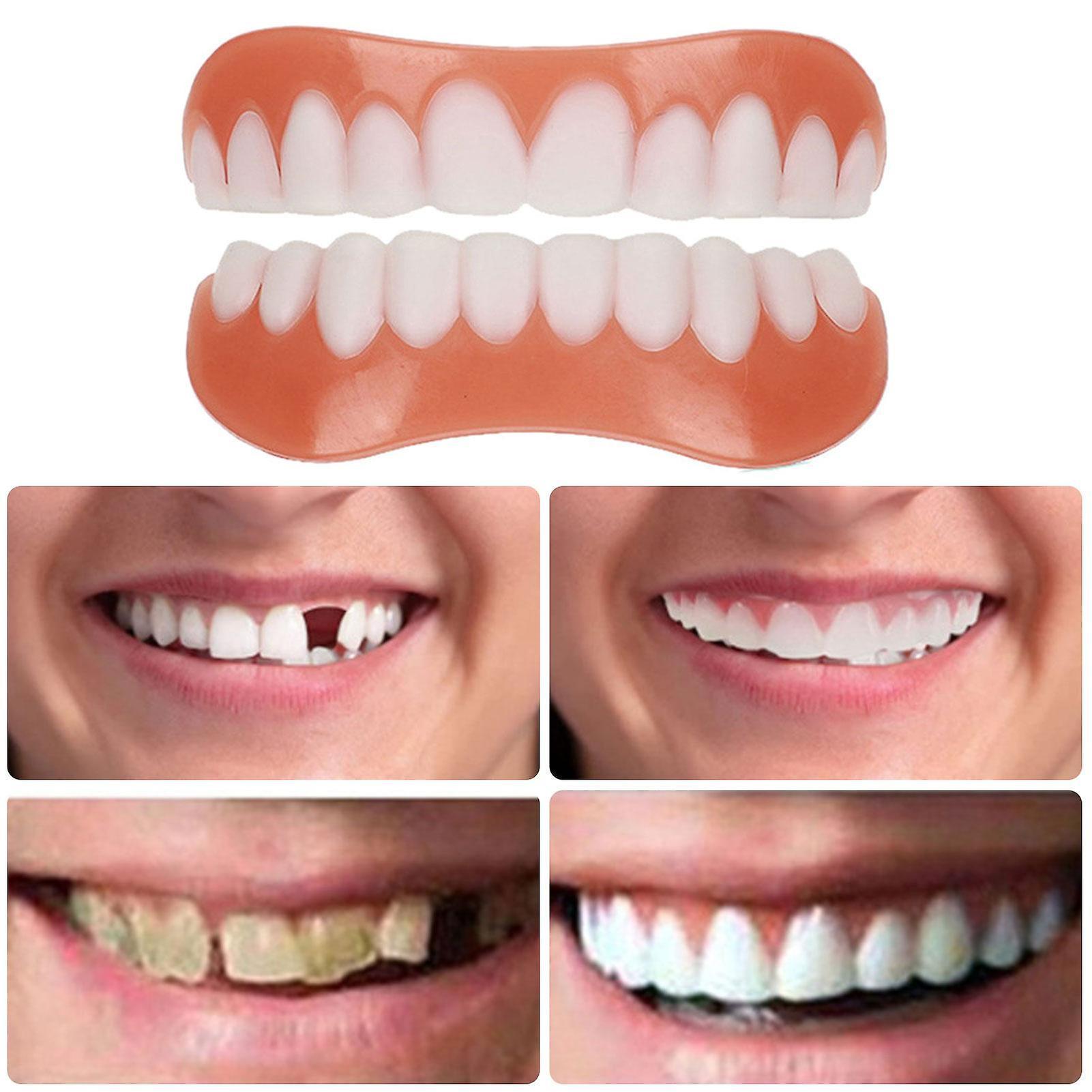 Finiss Professional Instant Smile Adults Upper Lower False Teeth Silicone Whole Dentures White Fake Teeth Dentures Adhesive Dentures