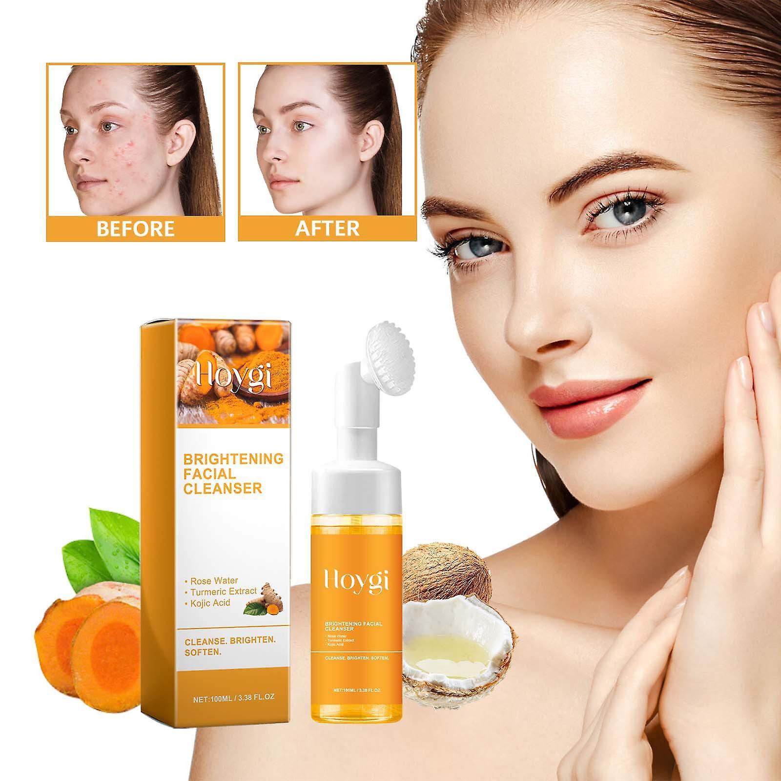 Frusde Turmeric Facial Cleanser, Brightening Foaming Face Wash Turmeric & Kojic Acid, Brightening Facial Cleanser, Turmeric Face Foaming Cleanser f...