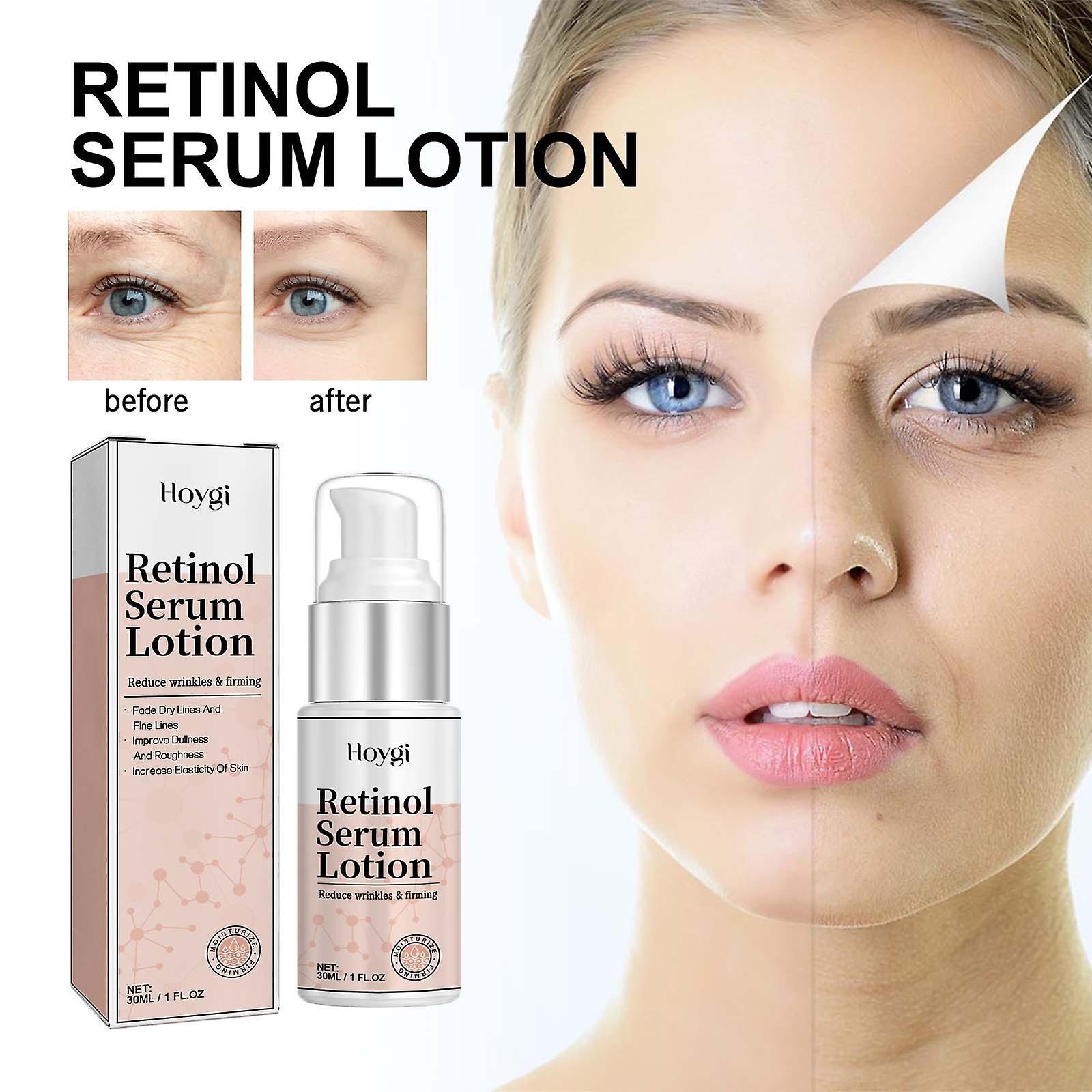 Flye Retinol Serum Lotion Retinol Lotion Retinol For Face  Retinol Serum Lotion 30ml 240756 Pink