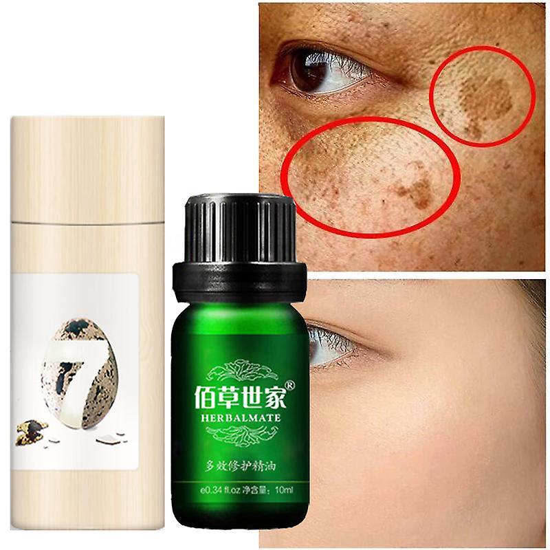 Sztlv Freckle Whitening Serum Curcumin Oil Brighten Fade Dark Spot Removal Pigment Melanin Correcting Beauty Face Skin Care