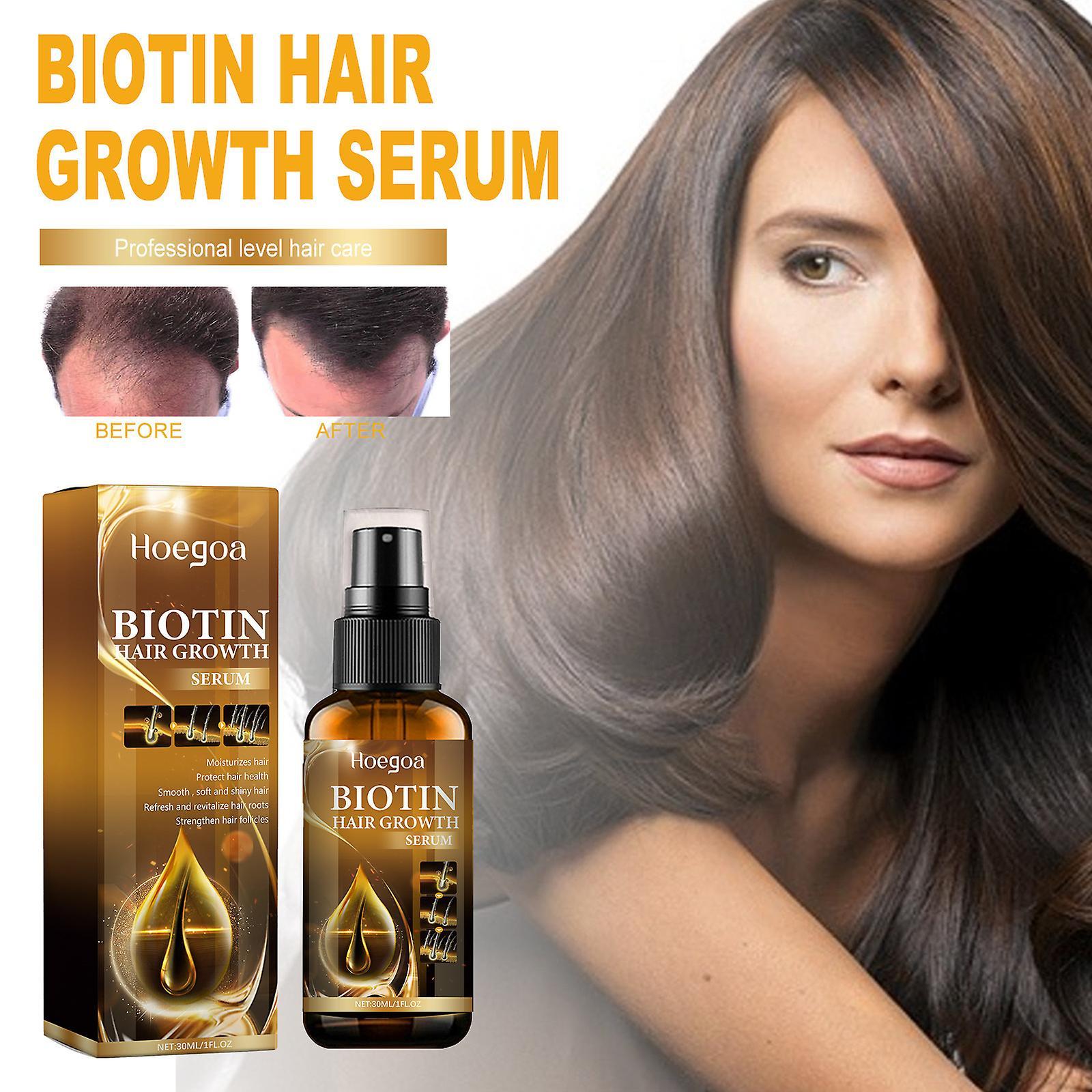 Frusde Biotin Premium Hair Growth Serum, Biotin Hair Growth Spray, Biotin Thickening Herbal Serum, Hair Growth Serum for Thicker Longer & Stronger ...