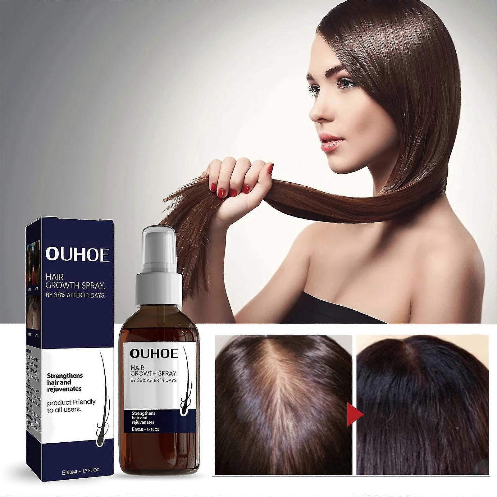 Jiuhaodian Ouhoe Hair Growth Spray Hydrates Damaged Scalp Hair Strong Hair Dense Hair Growth Spray-- Product Code 31126