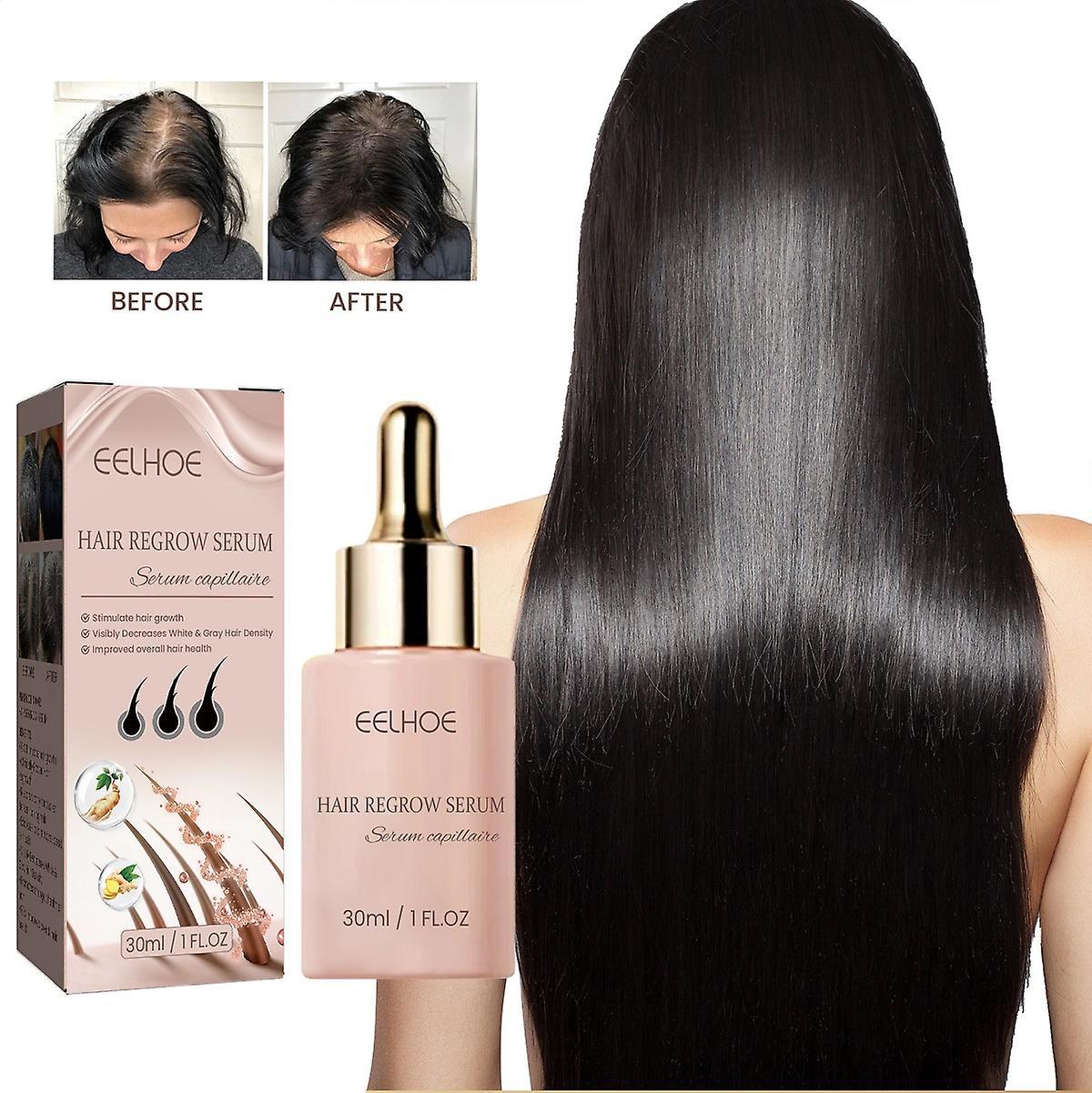 Frusde 30ml Hair Growth Serum For Thicker Fuller Healthier Hair, Reduces Breakage and Shedding 3Pcs