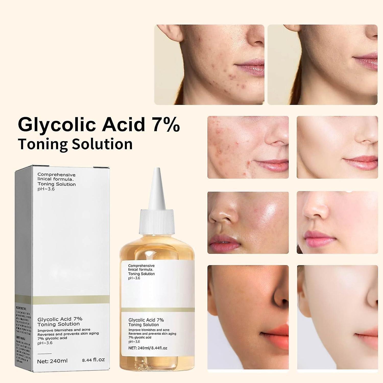 Fongwan Glycolic Sour 7% Toning Solution, Glycolic Acid Toning Resurfacing Serum Skin Repair For Blemishes Acne, Facial Exfoliation Astringe Pores ...