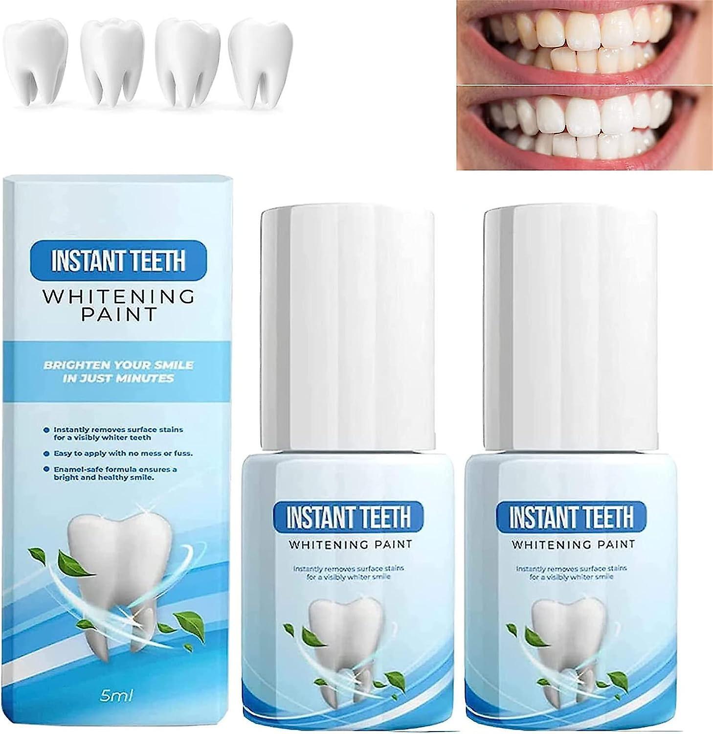 Frusde Whiteout Instant Teeth Whitening Paint, Gentle Teeth Whitening Gel, Tooth Polish Uptight White, Teeth Whitening Liquid Remove Tooth Stain 2pcs