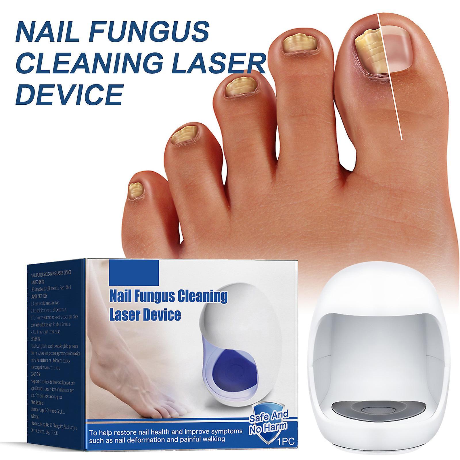 Fongwan Nail Fungus Laser Treatment Device, Nail Fungus Cleaning Laser Device For Toe&finger Nail Fungus Laser Treatment Restore Healthy Nails 2PCS A