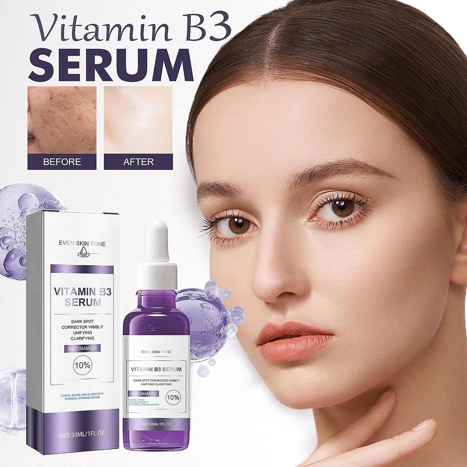 Lelinker Vitamin B3 Serum,Dark Spot Corrector With Anti-Aging Face Serum+10% Niacinamide,Skin Tone Corrector Serum Reduces Dark Spots,Niacinamide S...