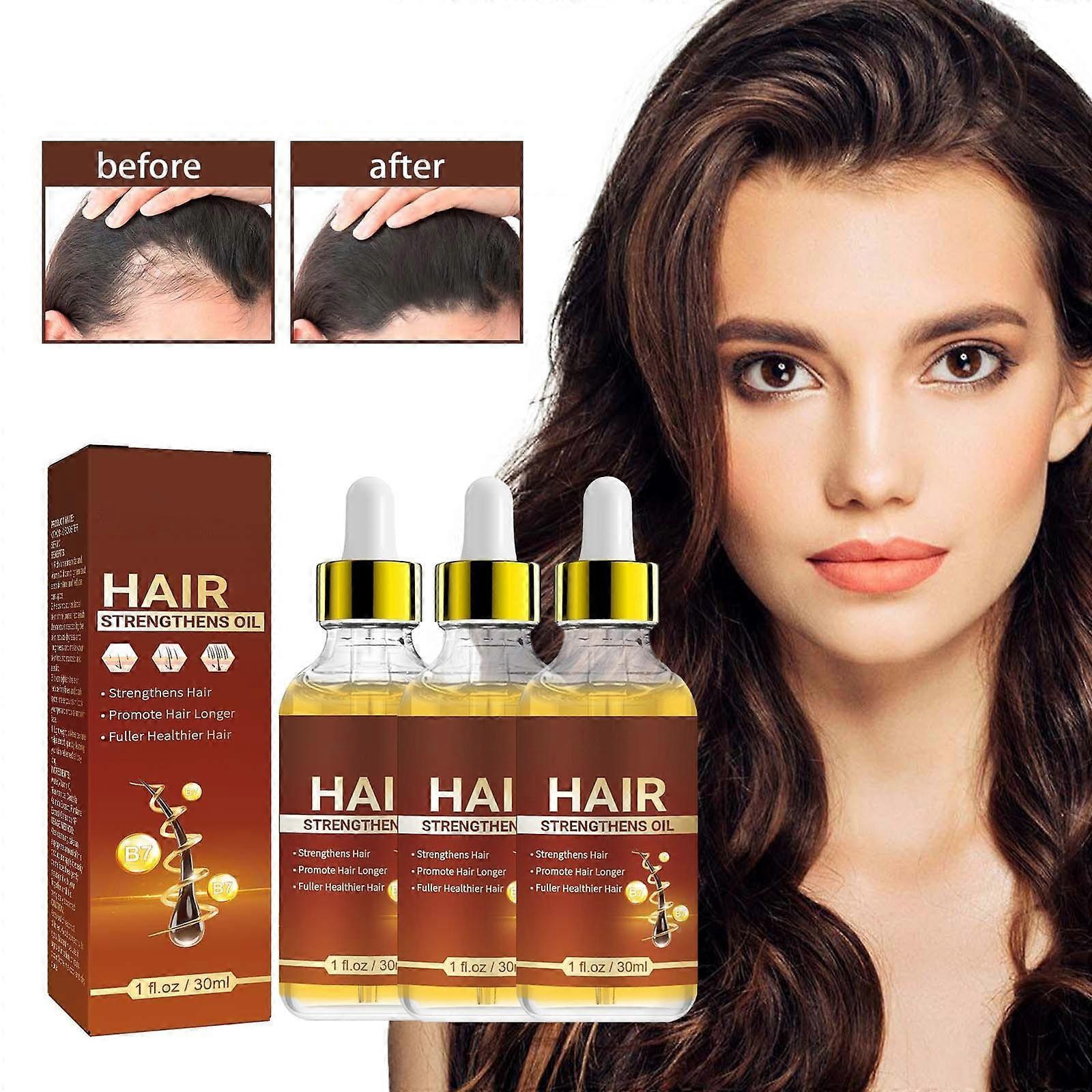 Flye 30ml Hair Growth Oil With Biotin And Castor  Hair Growth Serum For Thicker Longer Healthier Hair  Promotes Hair Regrowth  Hair Regrowth Oil 24...