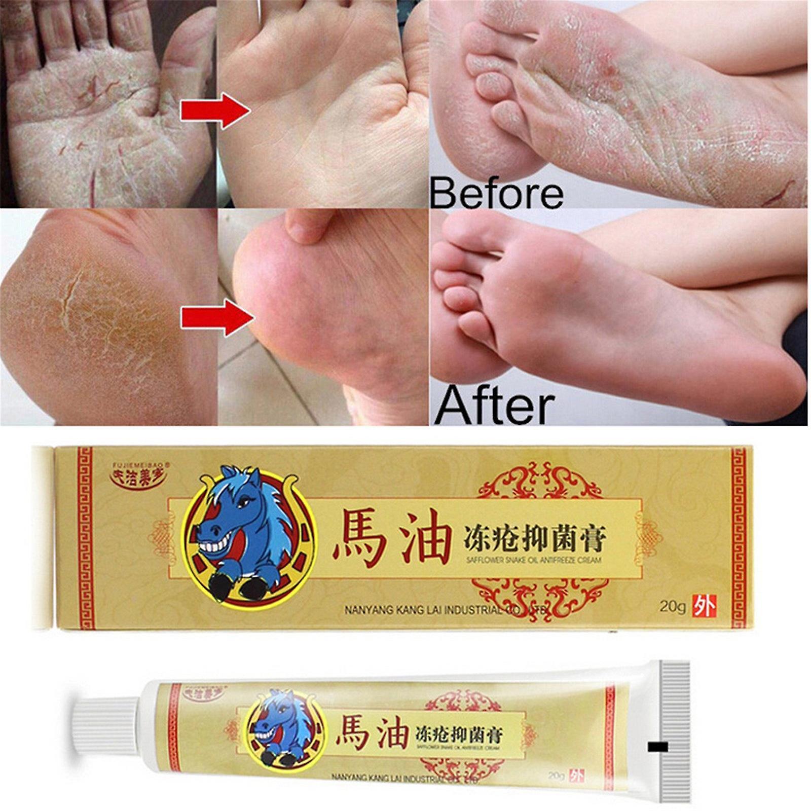 Kakanwo Horse Oil Feet Cream Itch Blisters Peeling Bad Feet Chilblains Ointment Multicolor One Size