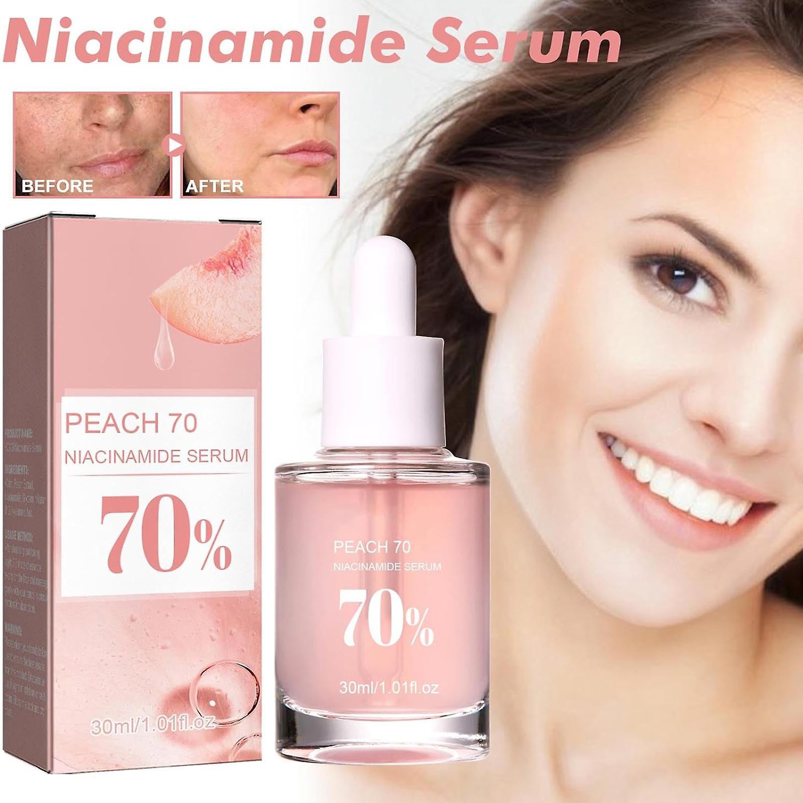 Nspiel 70% Niacinamide Face Serumm, Peach Essence Brightening Hydrating Face Serum, Daily Beauty Anti-aging Face Serum 1Pcs - 30ML