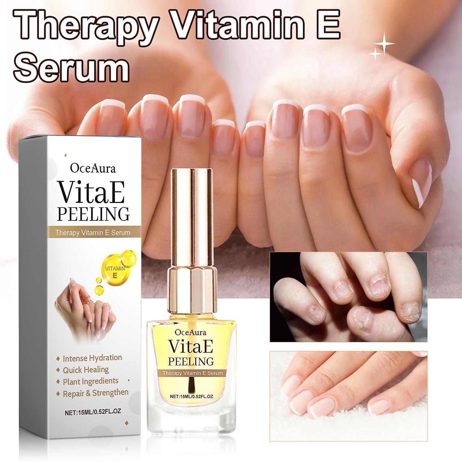 Frusde Peeling Nail Therapy Vitamin E Serum, Cuticle Nail Serum, Vitamin E Nail and Cuticle Oil, Nourish Dry Damaged Nails and Cuticles 1pcs