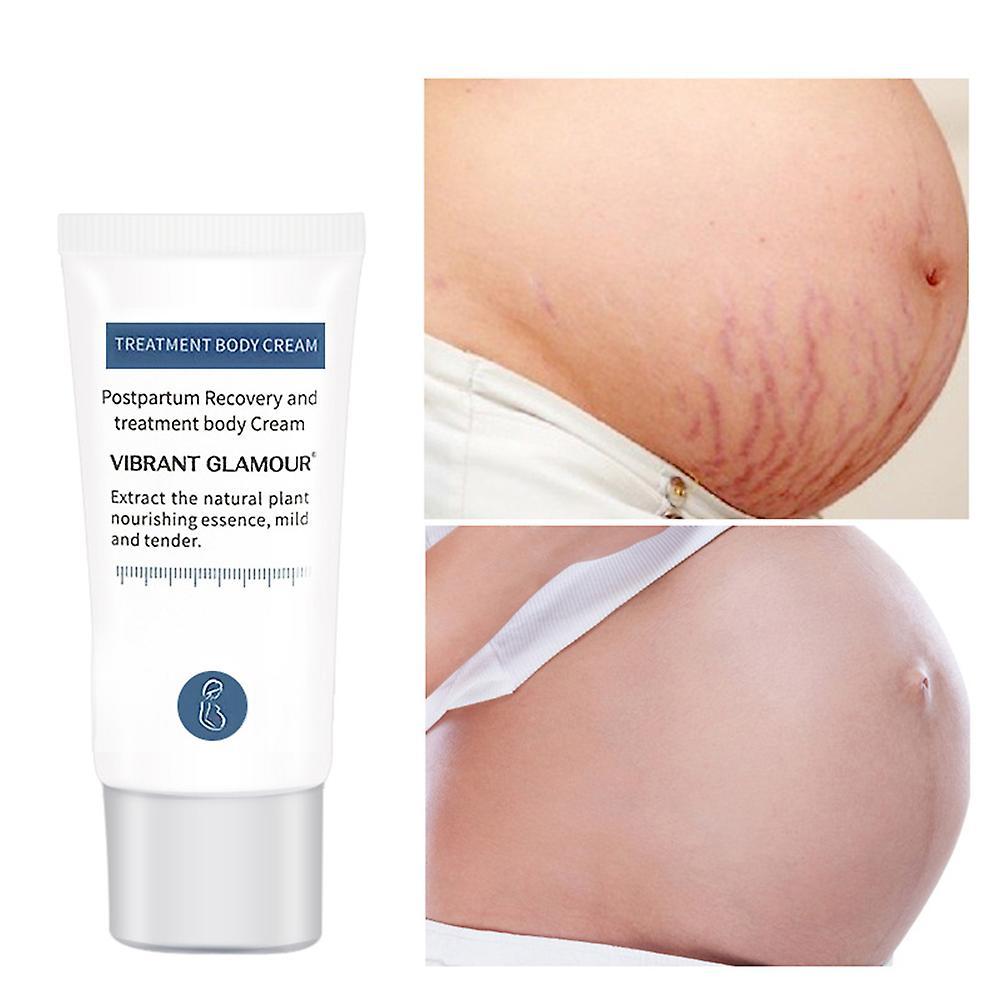 Pregnancy Stretch Mark Cream 30ml | Postpartum Scar Treatment for Obesity | Reduce Stretch Marks