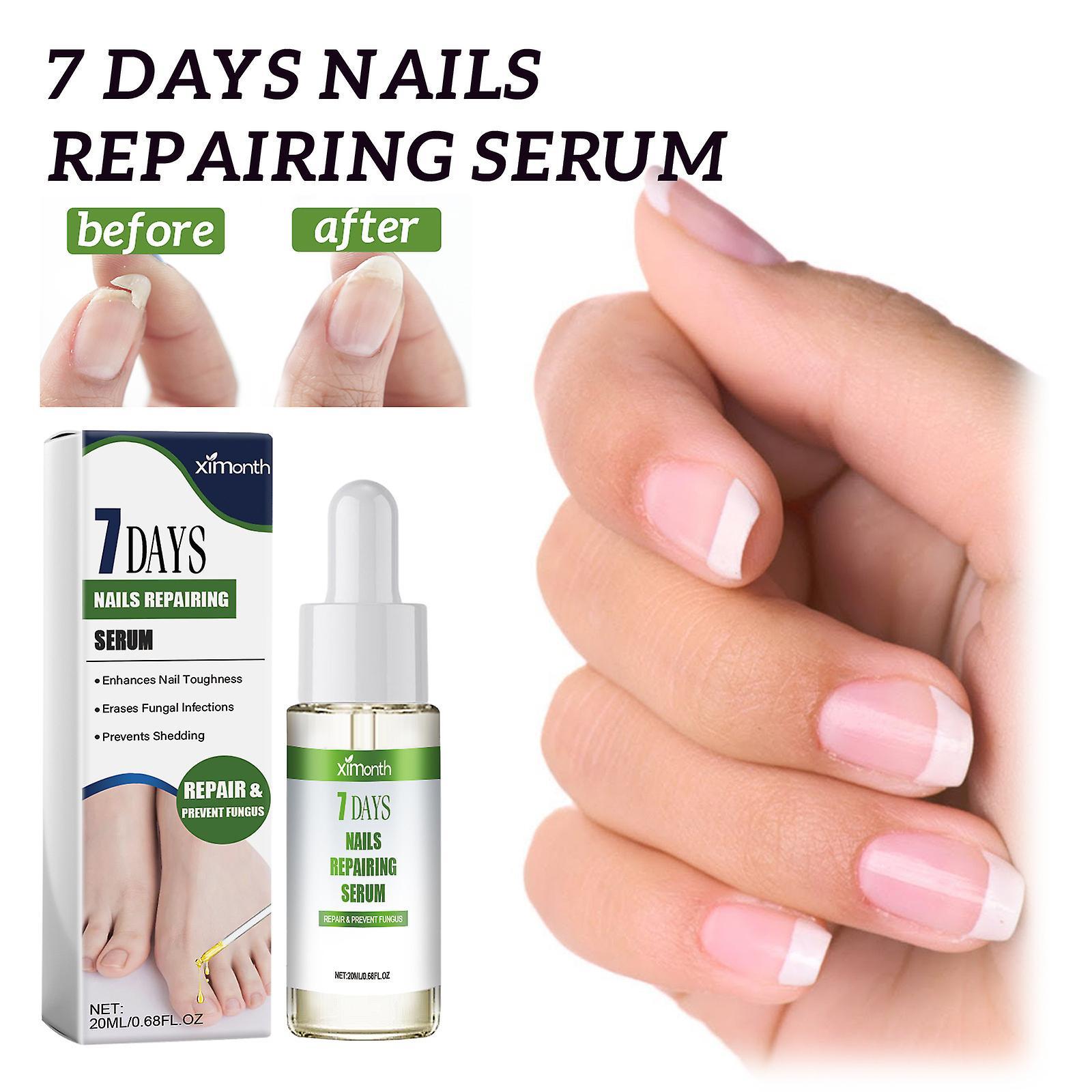 Lelinker 7 Days Nail Growth and Strengthening Serum Nail,Nail Serum Repair Essence, Nail Cuticle Oil Strengthener  for Growth and Repair for Damage...