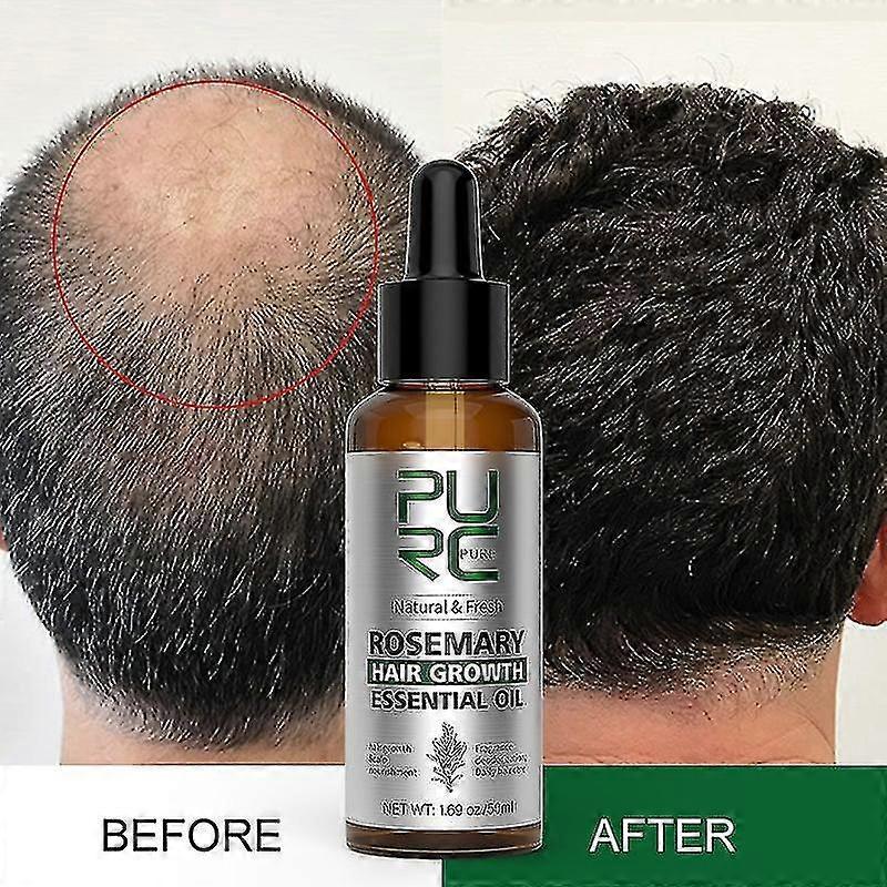 Shenzhenshileidakejimaoyiyouxiangongsi 50ml Rosemary Oil Hair Growth Product For Man Women Ginger Anti Hair Loss Fast Regrowth Thicken Oils Scalp T...