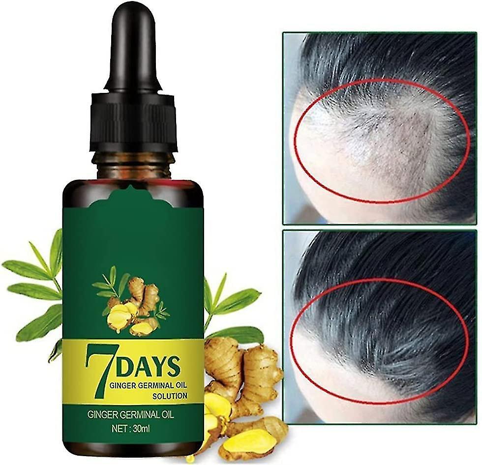 Serh Ginger Hair Growth Germinal Oil Regrow 7 Days Ginger Germinal Serum For Nourishing Hair Roots 50ml