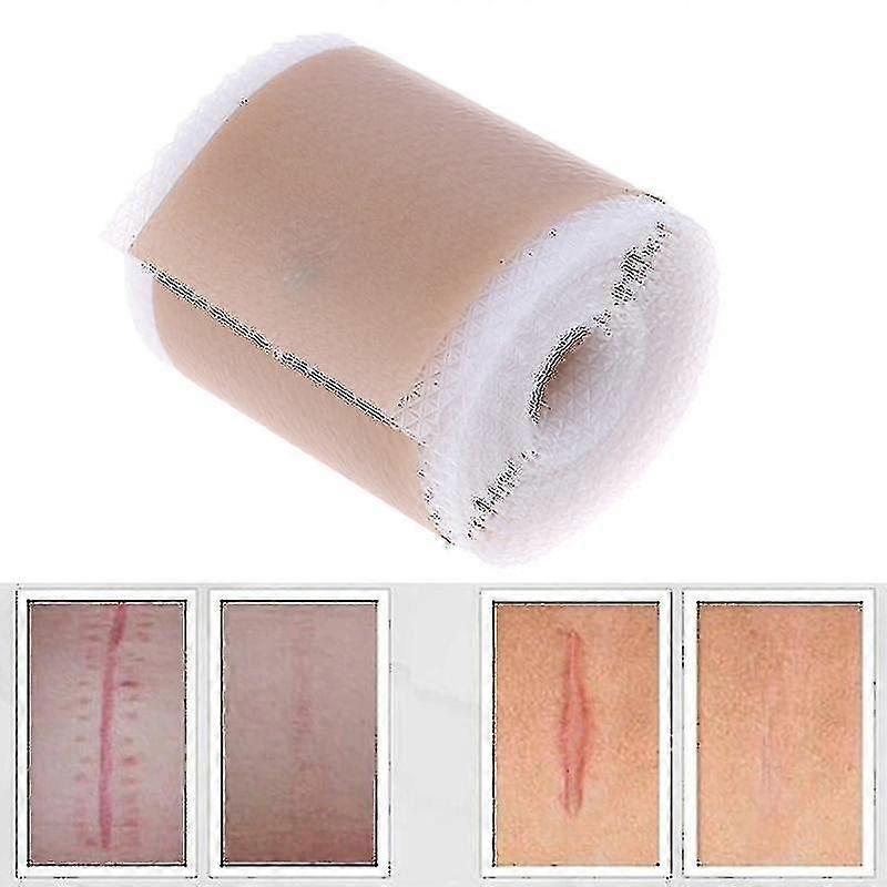 Lycxames Efficient Surgery Scar Removal Silicone Gel Sheet Therapy Patch For Acne Trauma Burn Scar Skin Repair Scar Treatment,4x150cm