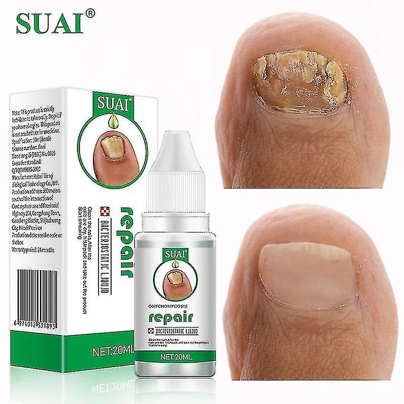 Bxs Suai-traitment Antifungal For Nails And Feet, Essence, Gel, Anti-betection, 20ml