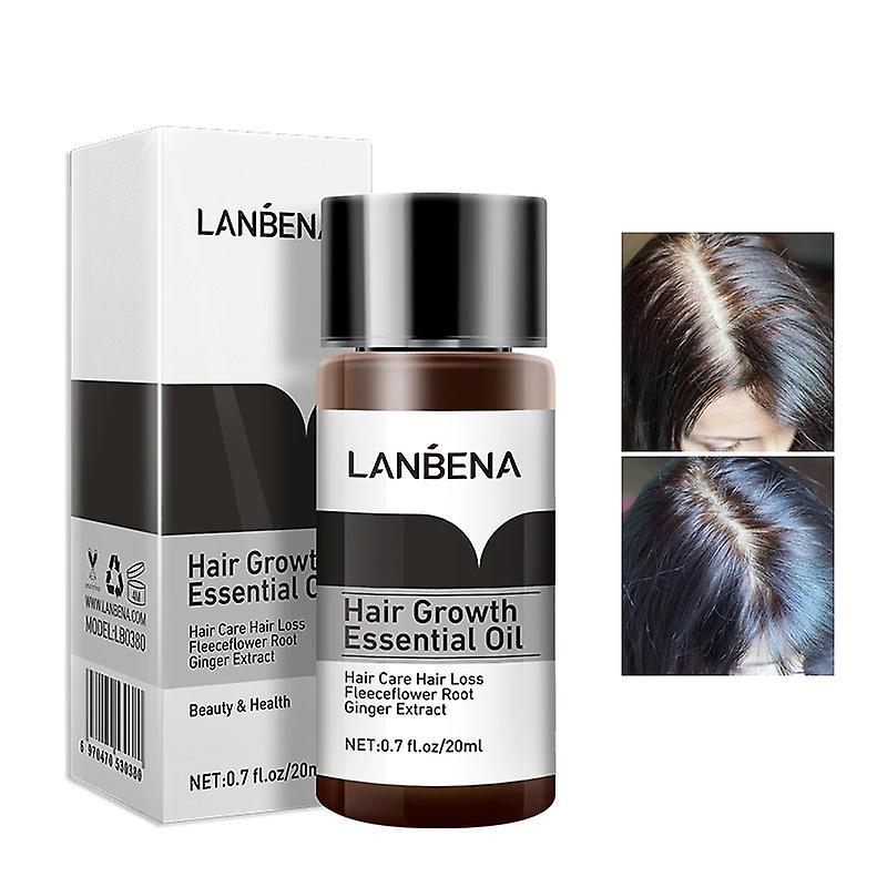 Slowmoose Hair Growth Essence - Oil Liquid Treatment Preventing Loss