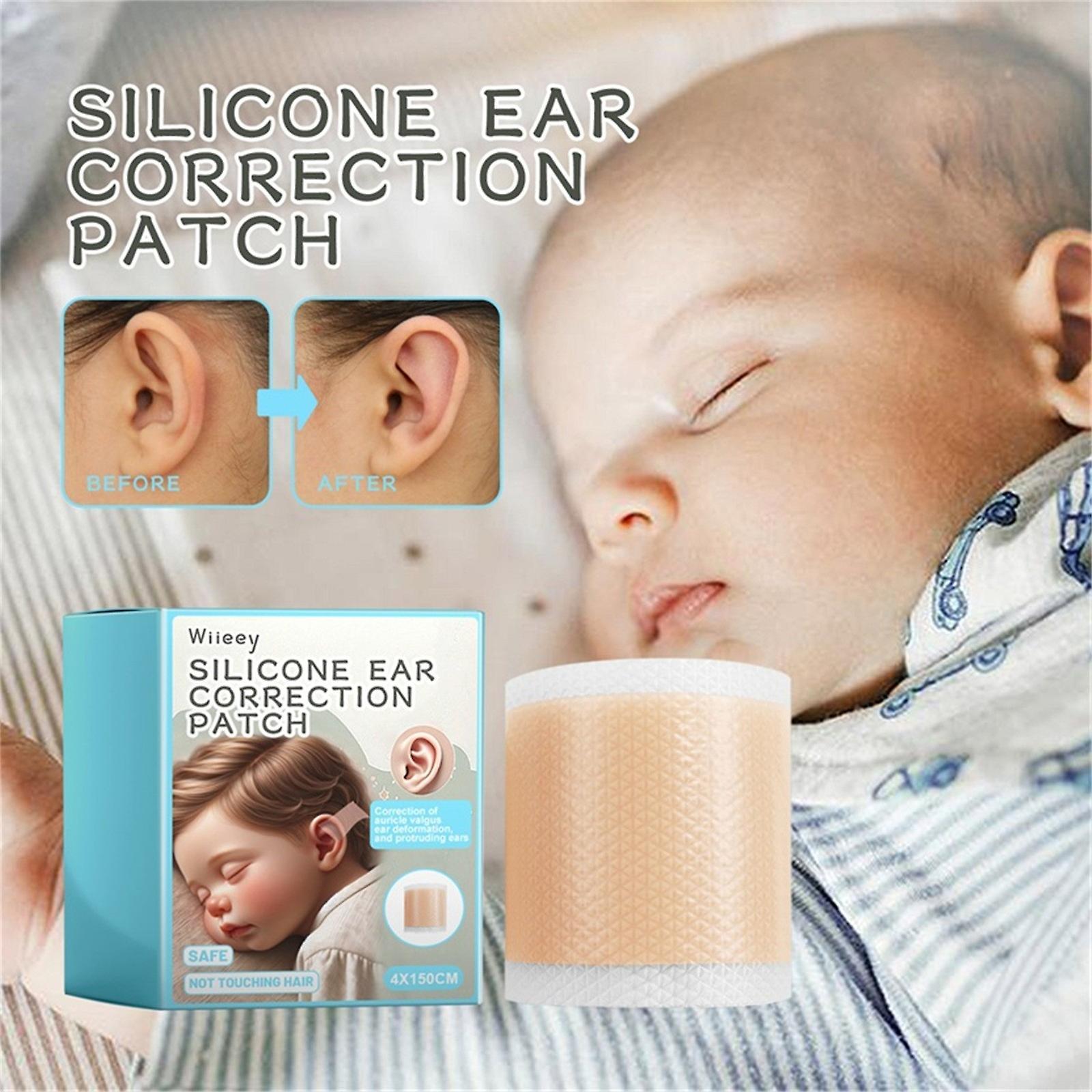 Baodan Baby Soft Breathable Silicone Ear Correctors Tape Baby Auricle Valgus Correction Patch For Child Infant Baby Ear Correction Health Care Ear ...