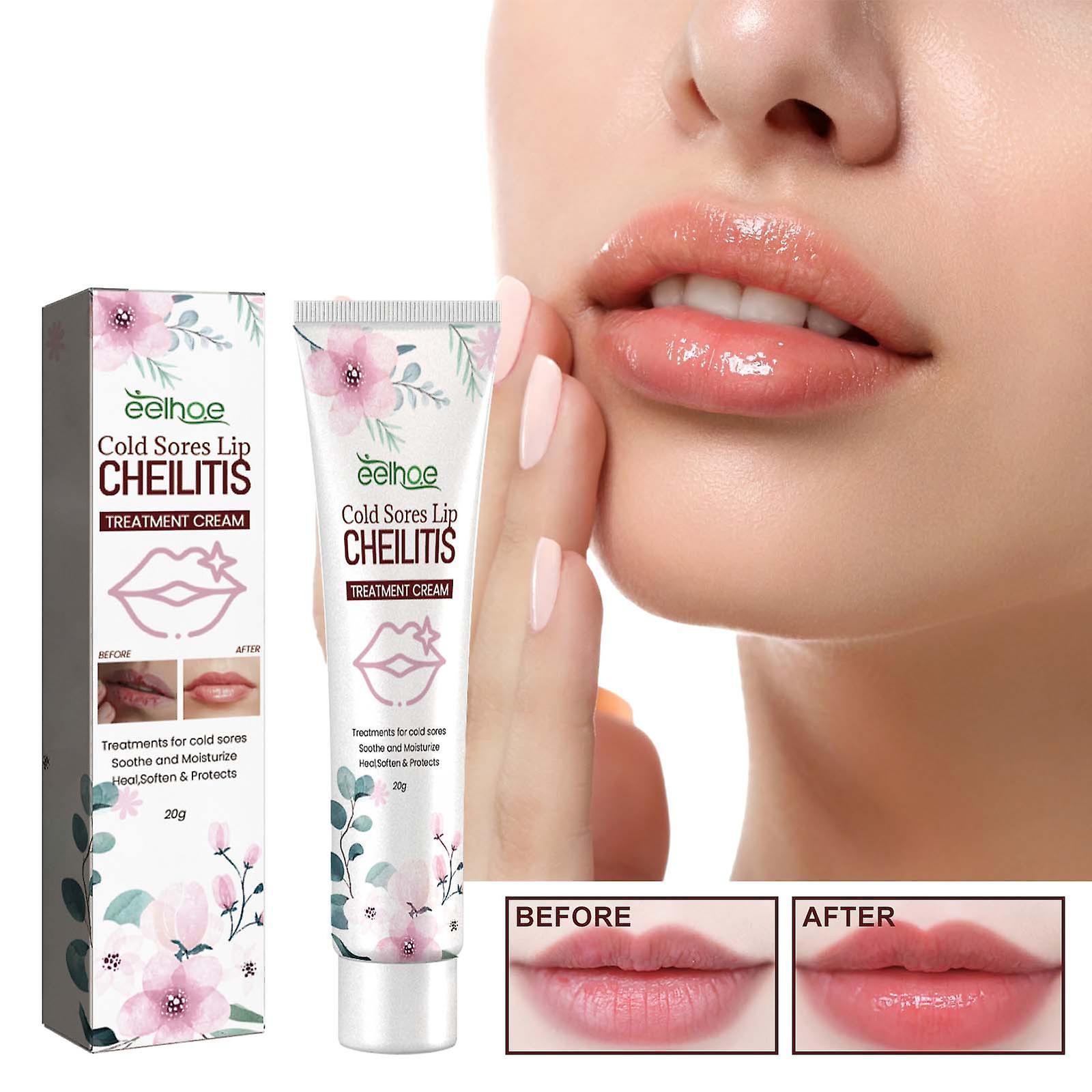 Gaoguan Lip Herpes And Cheilitis Cream, Effectively Nourishes Lips, And Regularly Uses To Have Beautiful Lips Pink