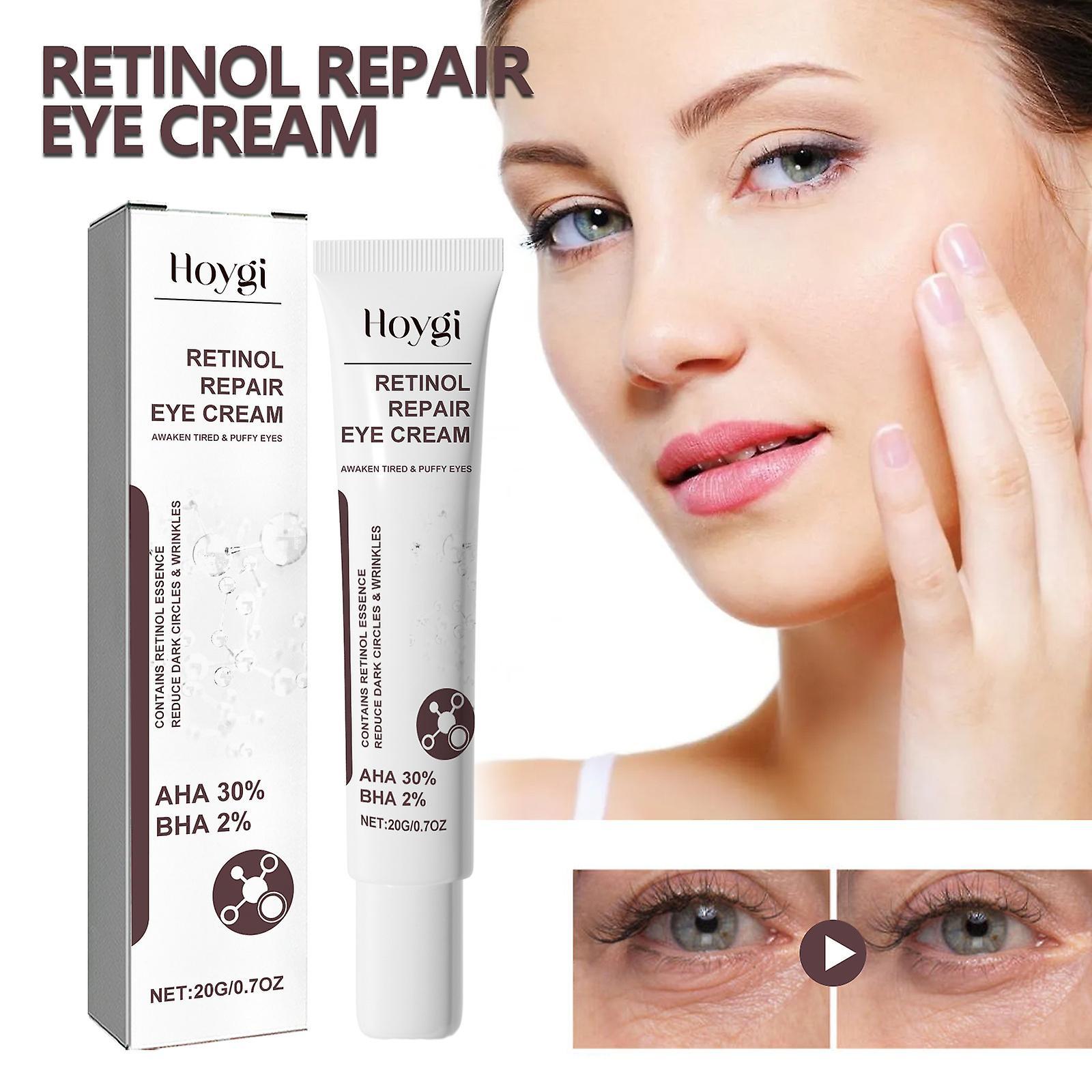 Fongwan Retinol Repair Eye Cream, Anti-Aging Retinol Eye Serum, Rapid Wrinkle Repair Retinol Eye Cream for Dark Circles & Smooth Fine Lines 3pcs - 60g