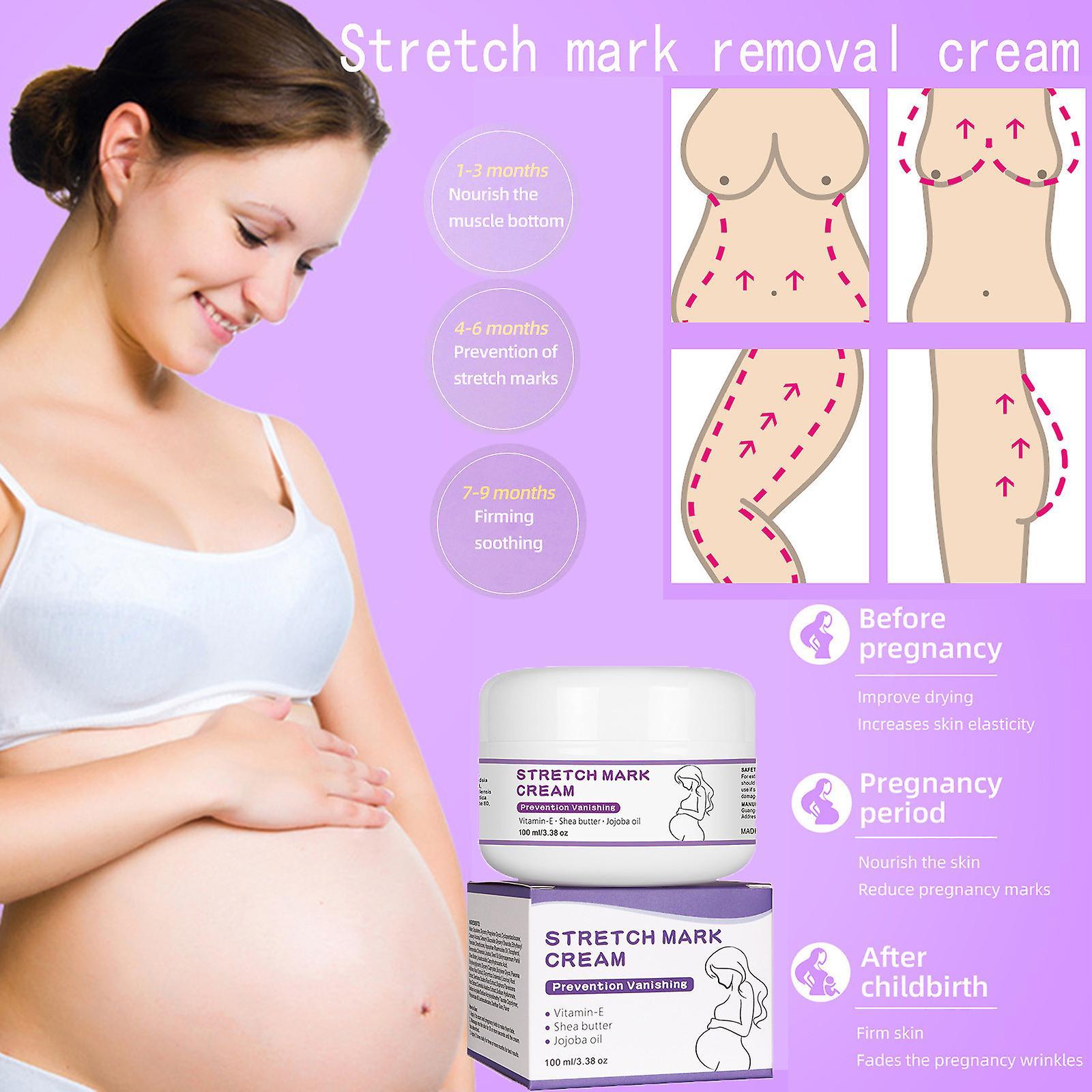 Baodan Skin Care Mommy Lapel Print Cream Prenatal Postpartum Pregnancy Stretch Mark Removal Cream As shown