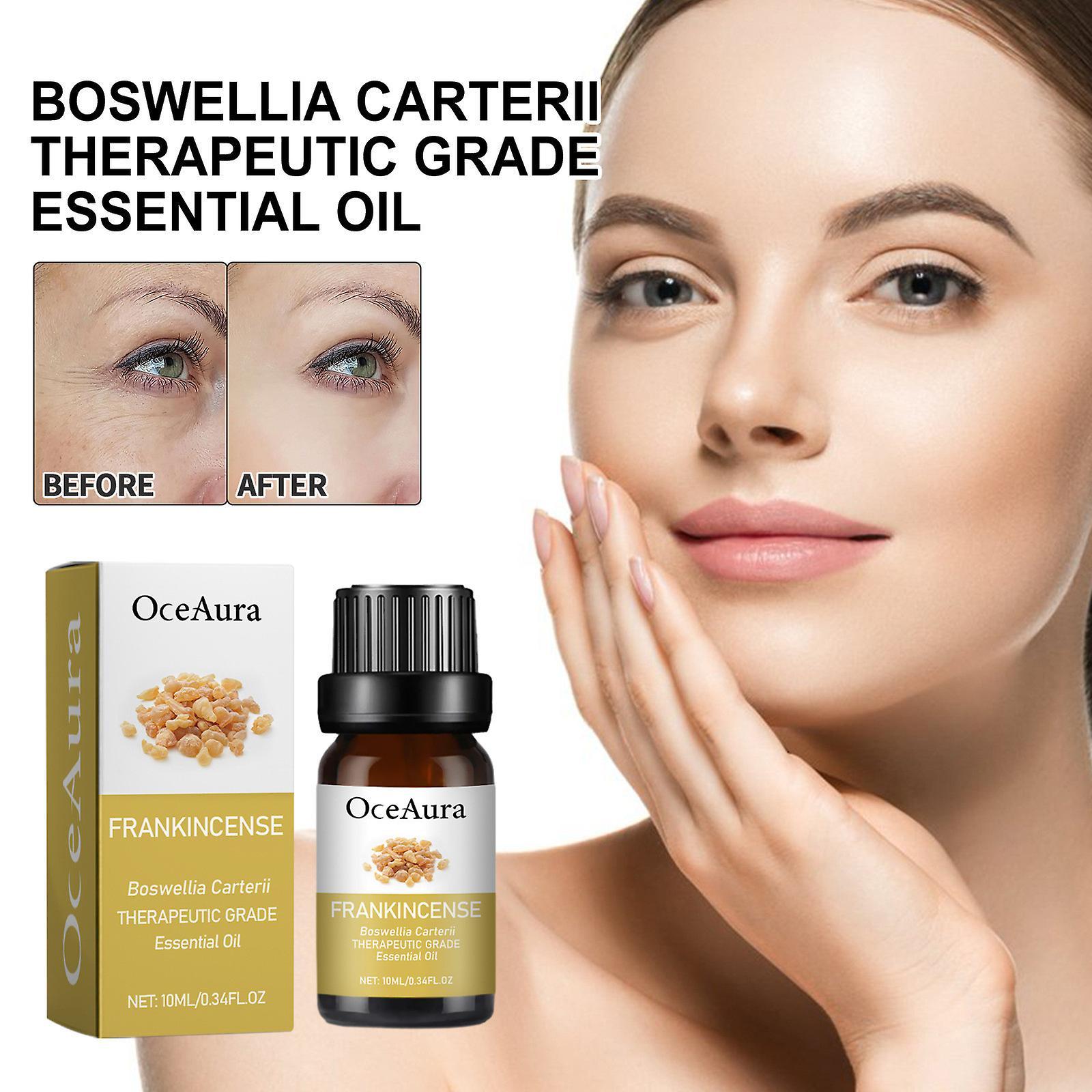 Flye Boswellia Carterii Therapeutic Grade Essential Oil 10ml FLY1020 A