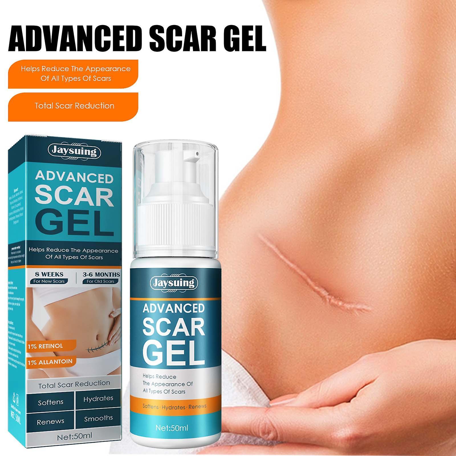 Flye Advanced Scar Gel For Scar Stretch Marks Type C Burn Scar,child Scar Softens And Smoothes Scar Blue