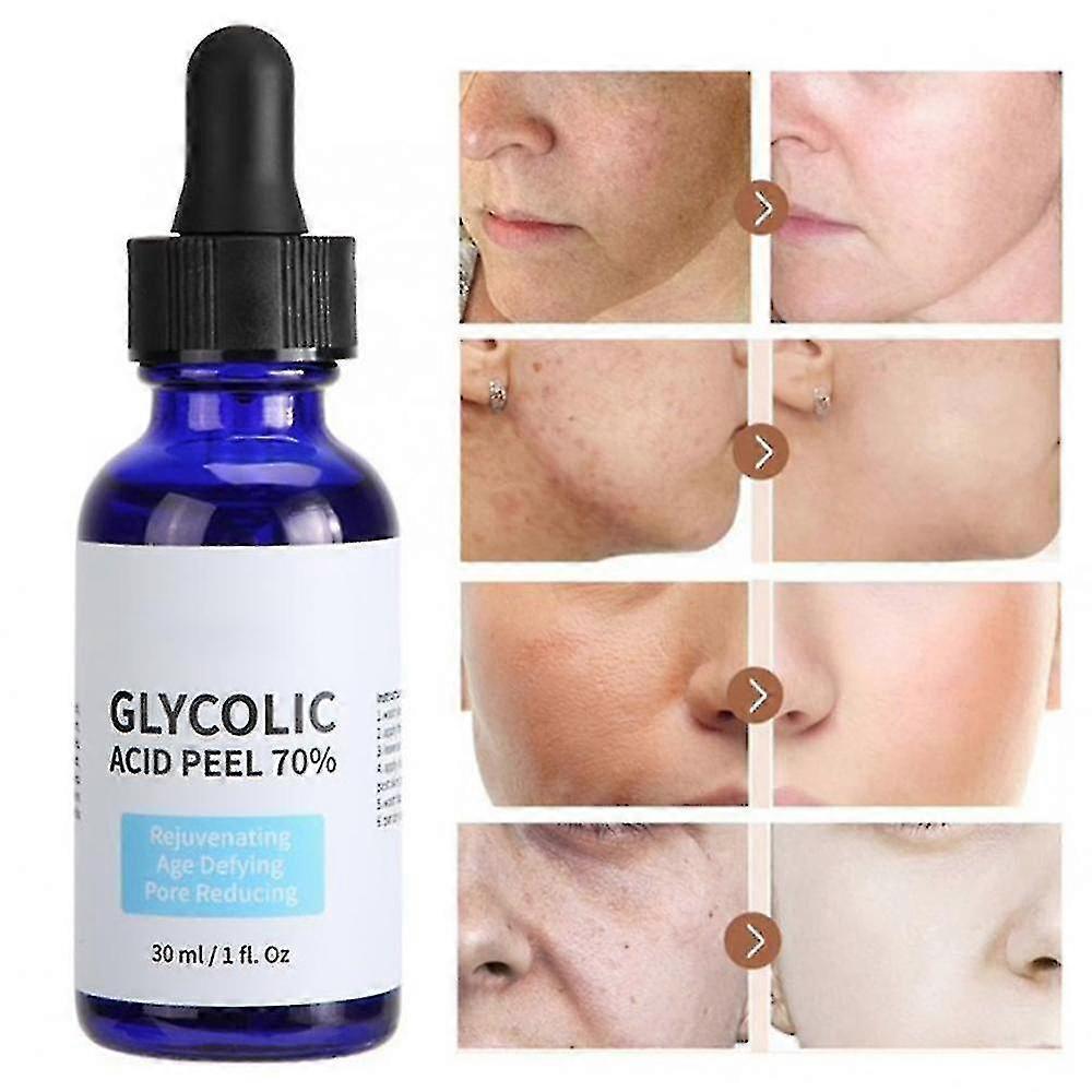 Botribas Glycolic Acid Exfoliating And Repairing Liquid-shrink Pores And Brighten Skin Tone, Improve Acne