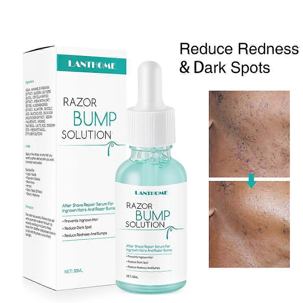 Unbrand Razor Bumps Treatment for Women and Men, Anti-Bumps Solution, After Shave Repair Serum, Reduces Redness & Dark Spots, Prevents Ingrown Hair...