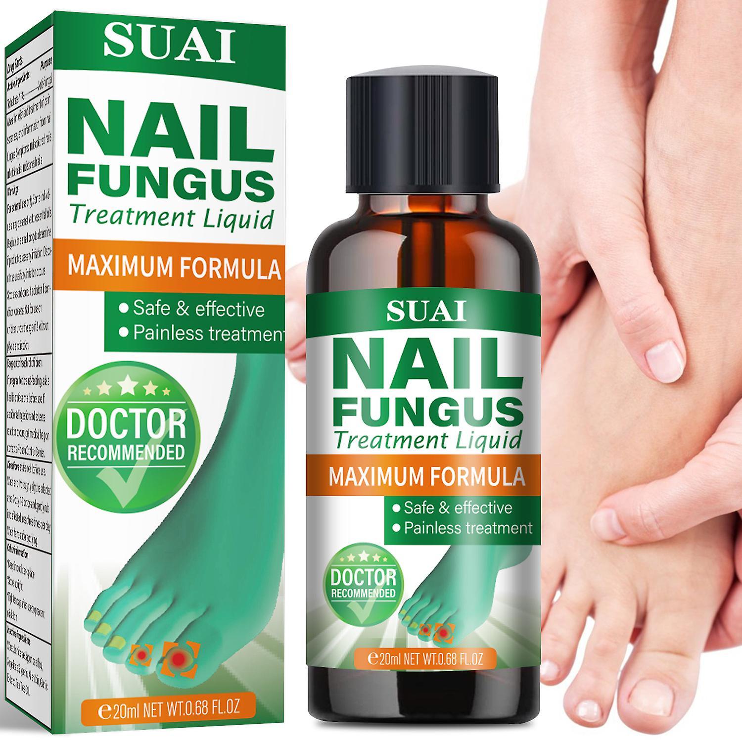 Antbaba Nail Fungus Treatment Liquid, Nail Fungus Treatment for Toenail and Fingernail, Extra Strength Toenail Fungus Treatment For Damaged & Disco...