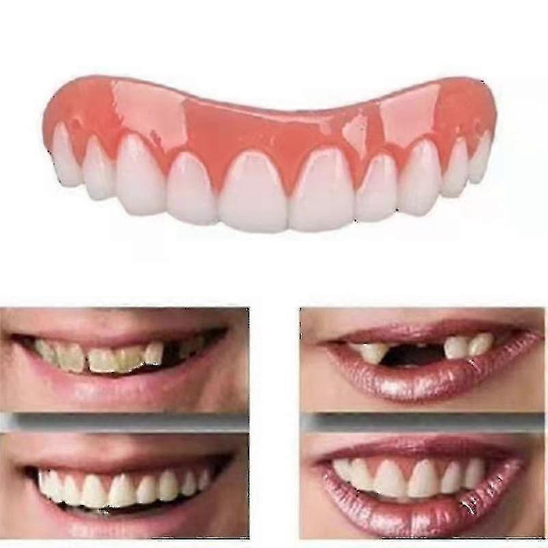 Shmshng 2 Sets Of Dentures, Upper And Lower Jaw Dentures, Natural And Comfortable, Protect The Teeth, And Regain A Confident Smile