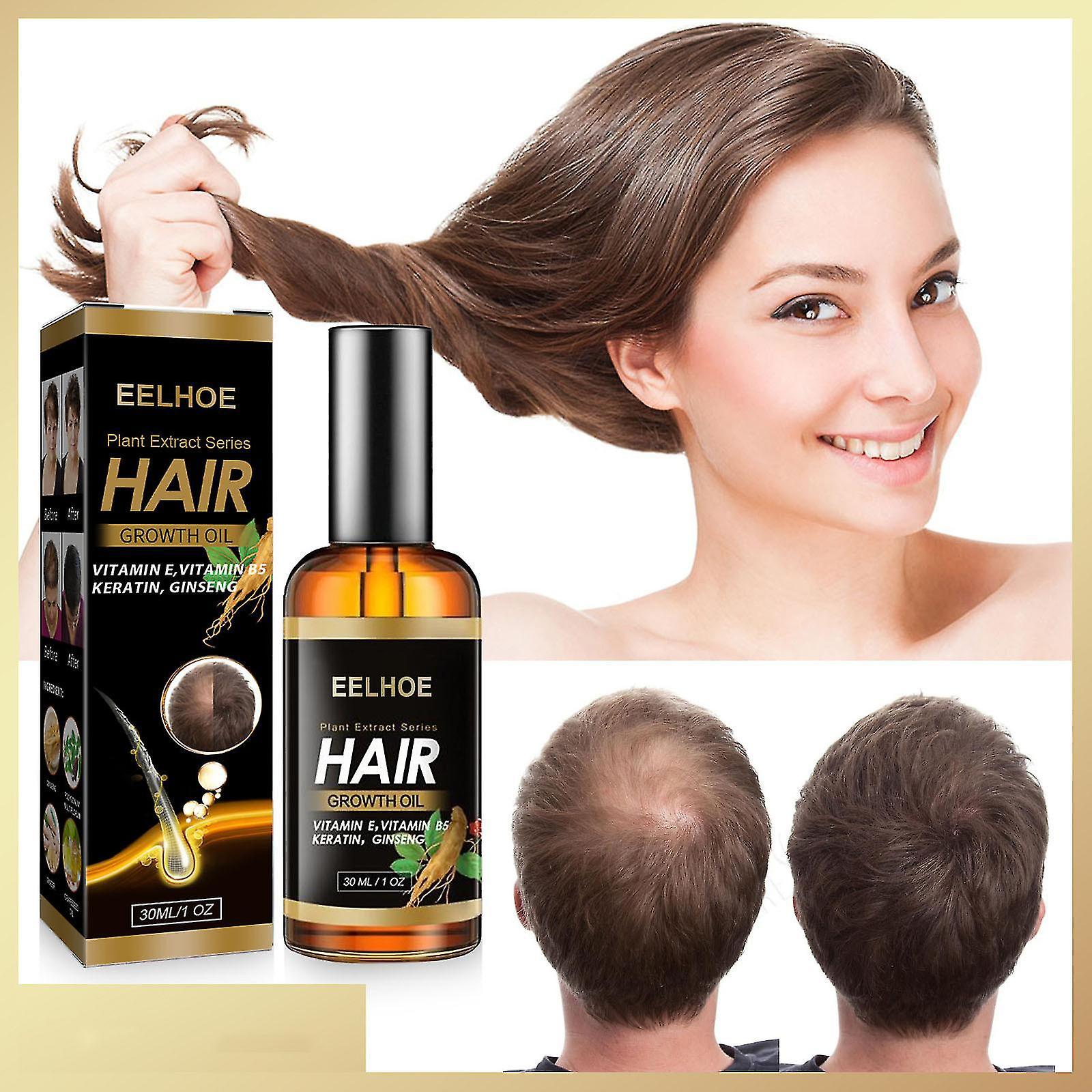 Exsha Eelhoe Ginger Hair Growth Oil 30ml