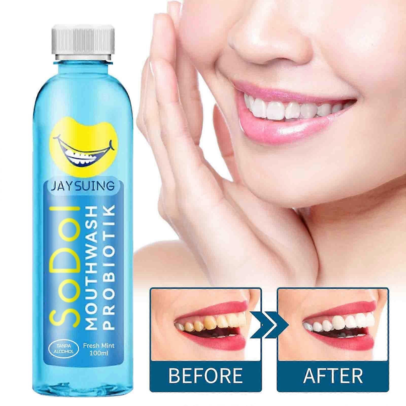 Congjing Mouthwash, Calculus Removal, Teeth Whitening, Healing Mouth Ulcers, Eliminating Bad Breath,  Caries 100ml